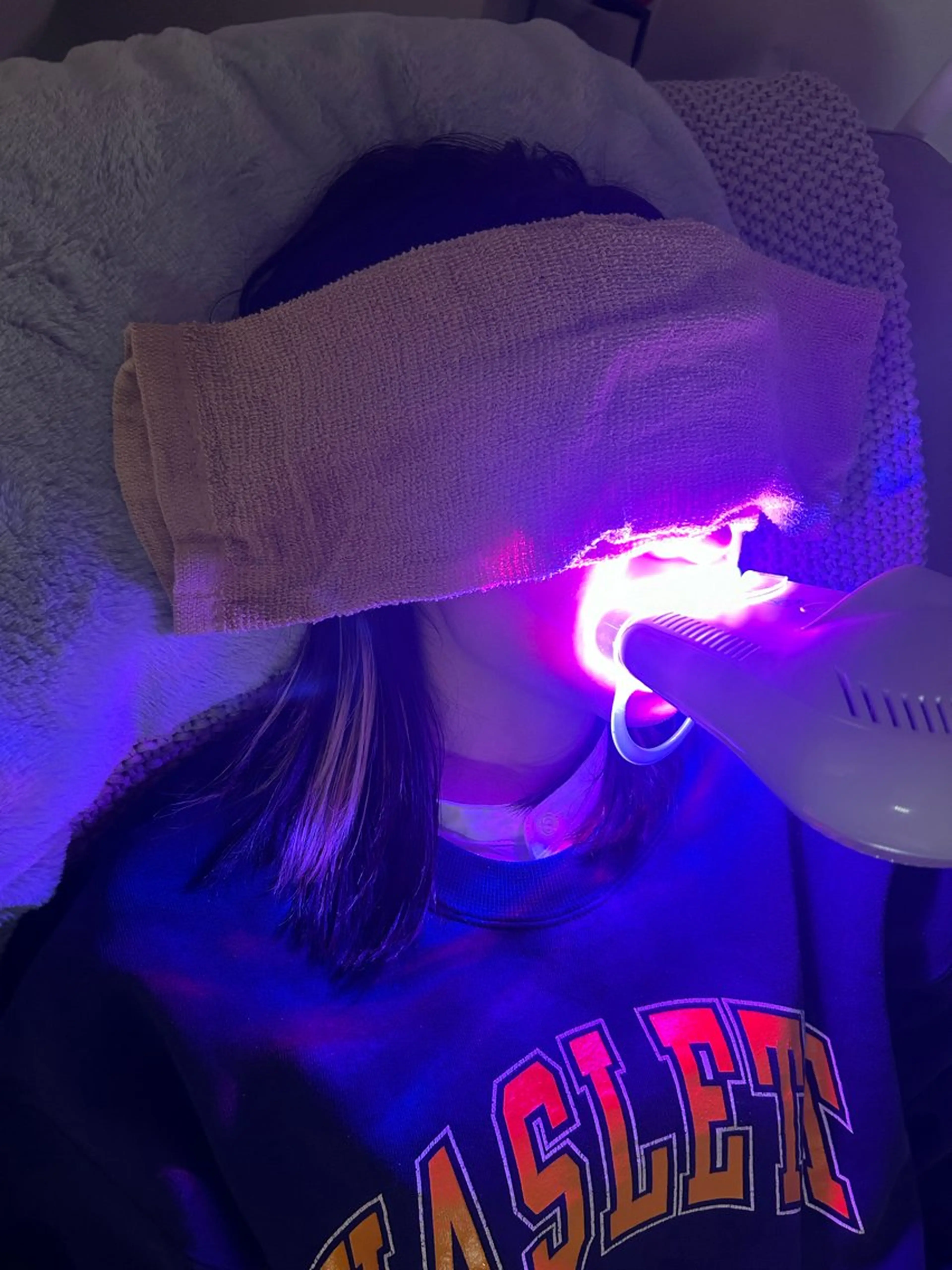 io teeth careのその他イメージ