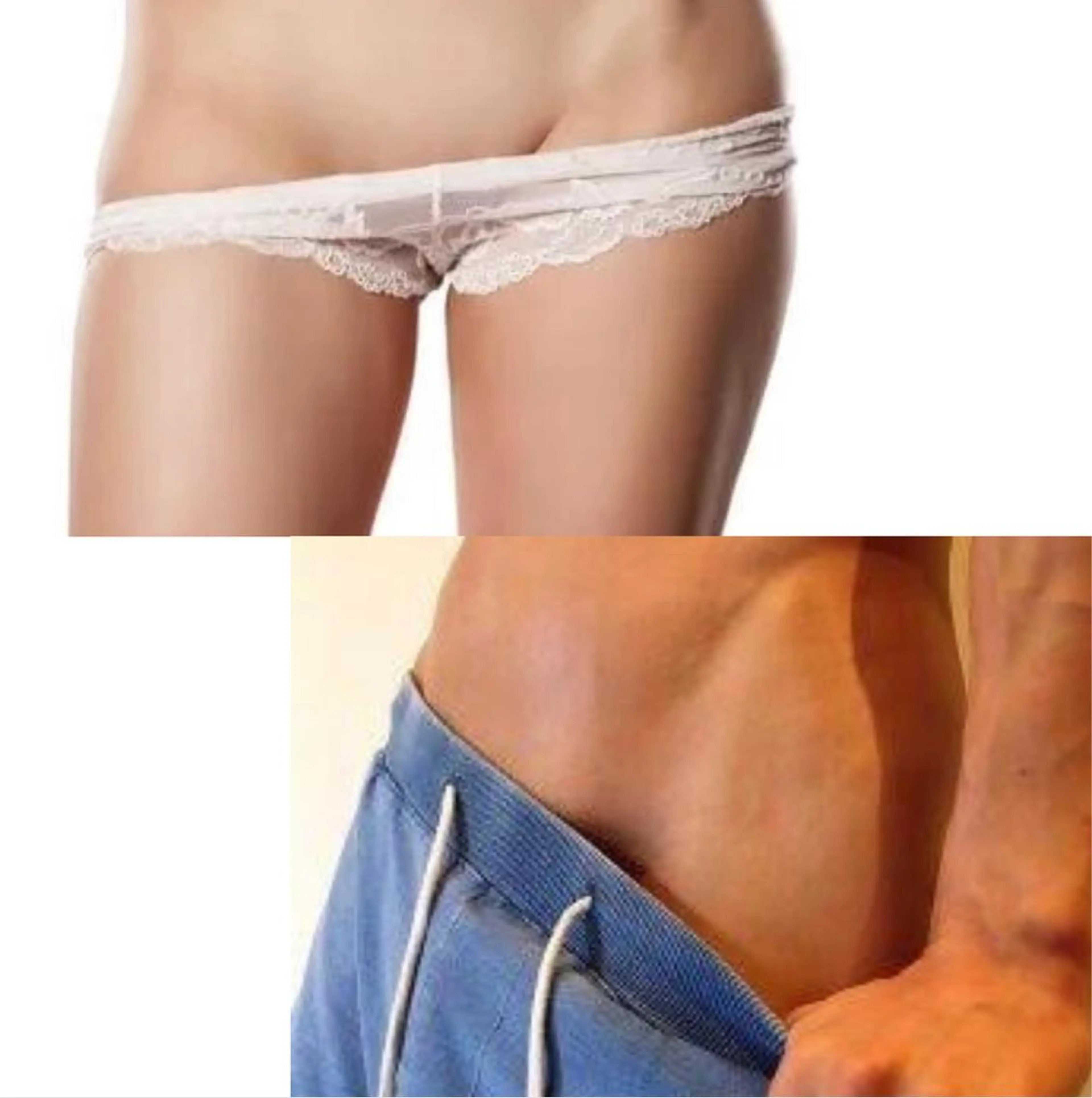 【今だけの特別価格！】大人気♪お得に体験VIO脱毛の写真