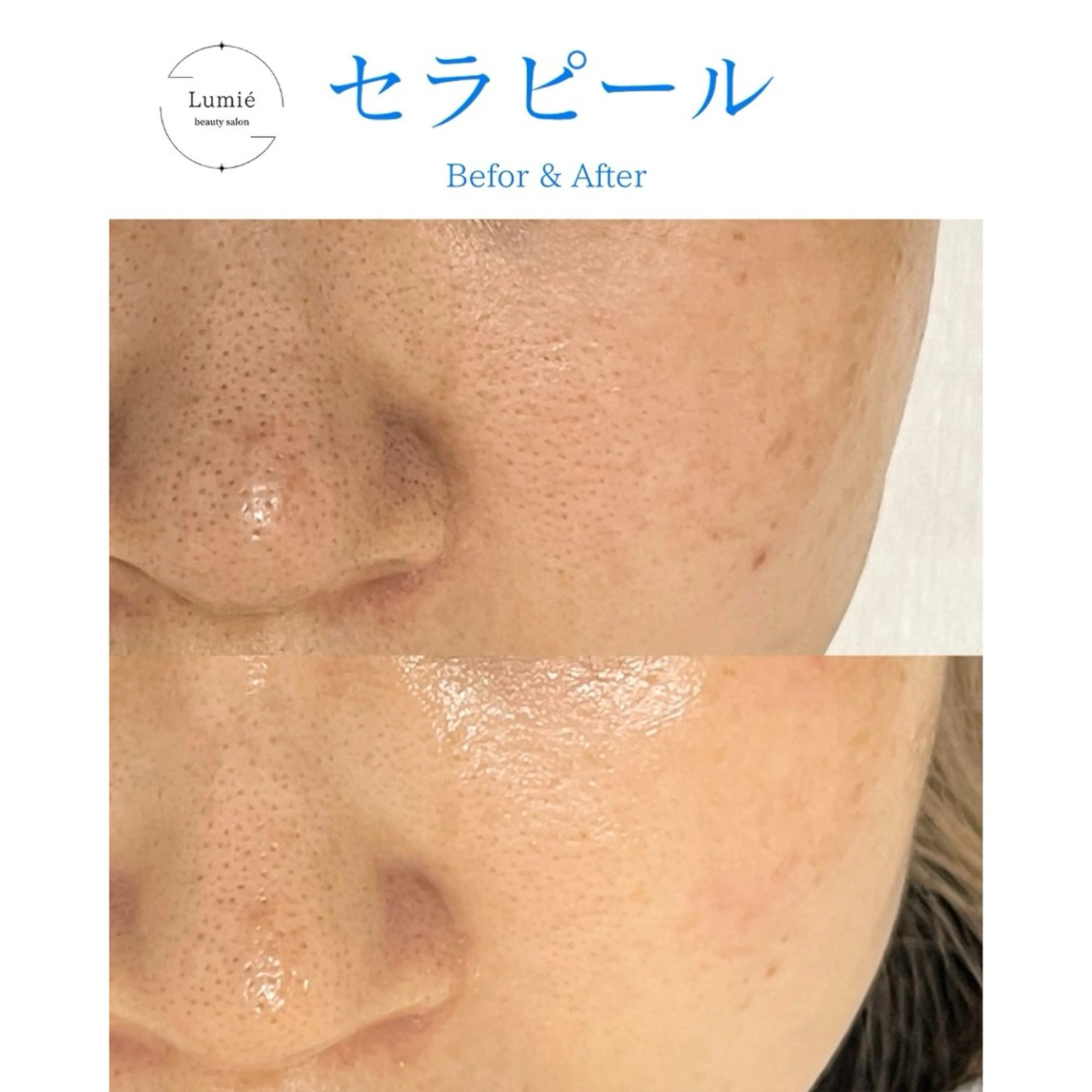 水玉リフティング🫧 Lumie恵比寿店のエステ・リラクイメージ