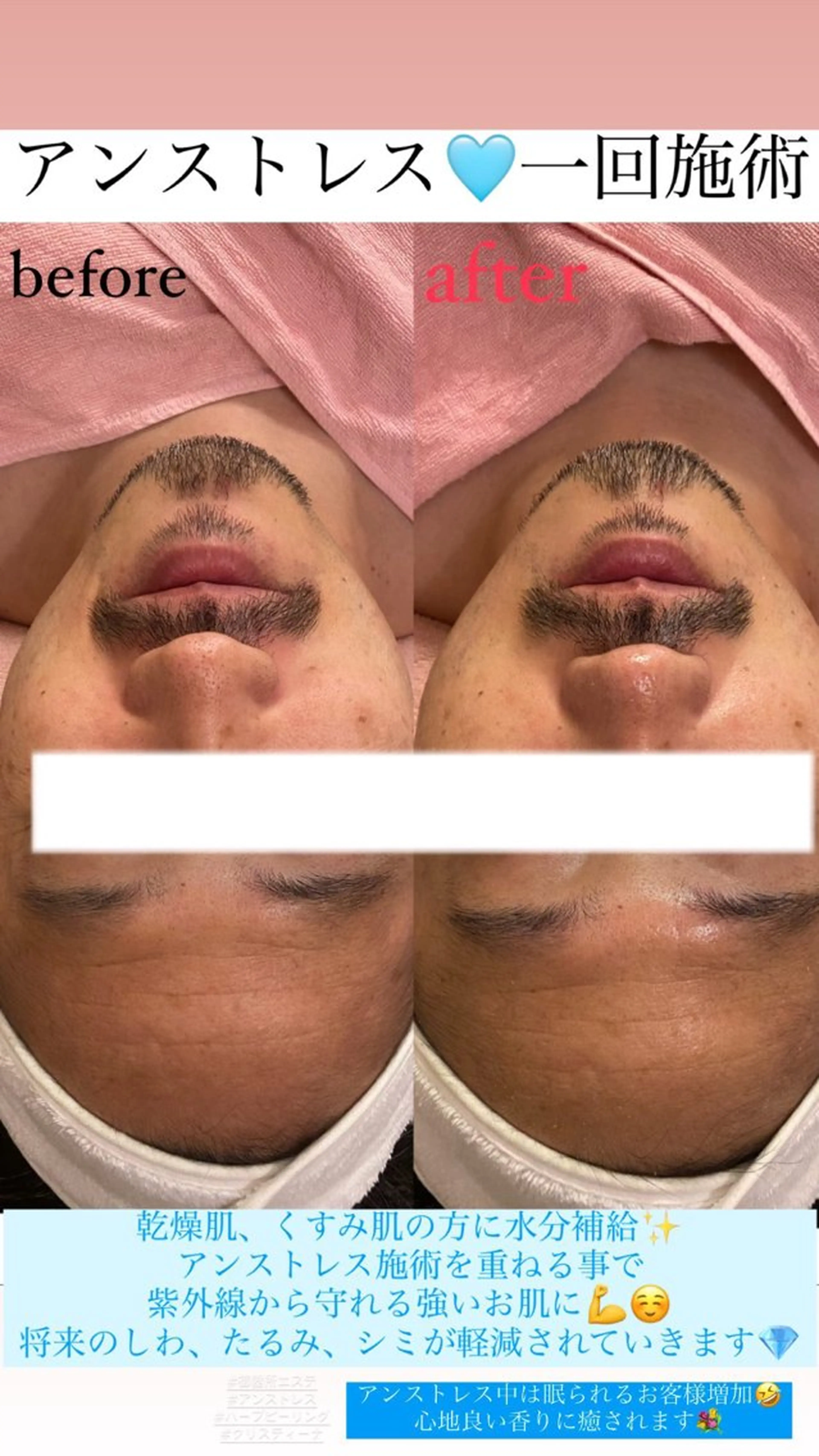 メンズ エステ Salon de Lino 御器所のエステ・リラクイメージ