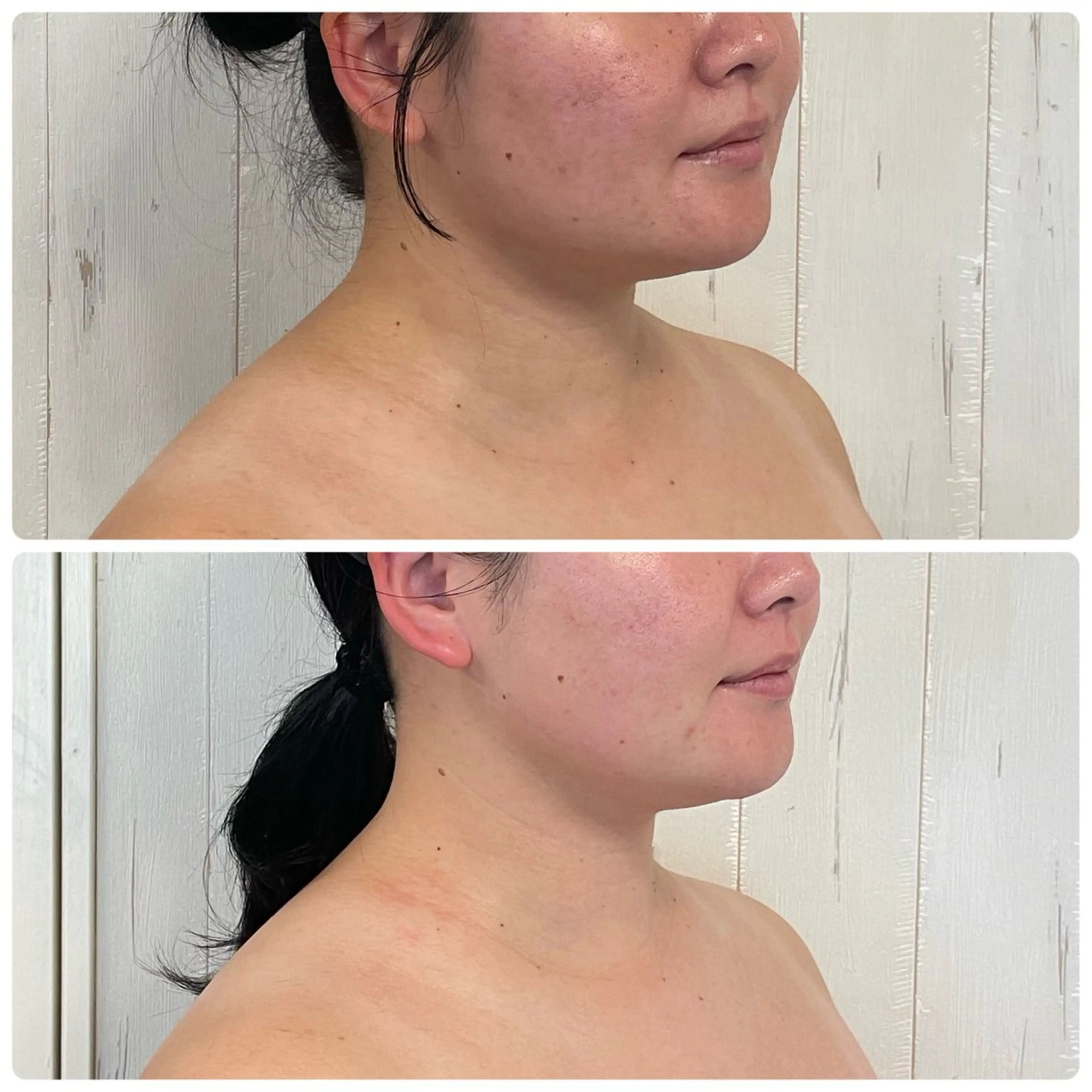 エステ リラク 小顔・たるみケア✨ フェイシャル&ボディのエステ・リラクイメージ