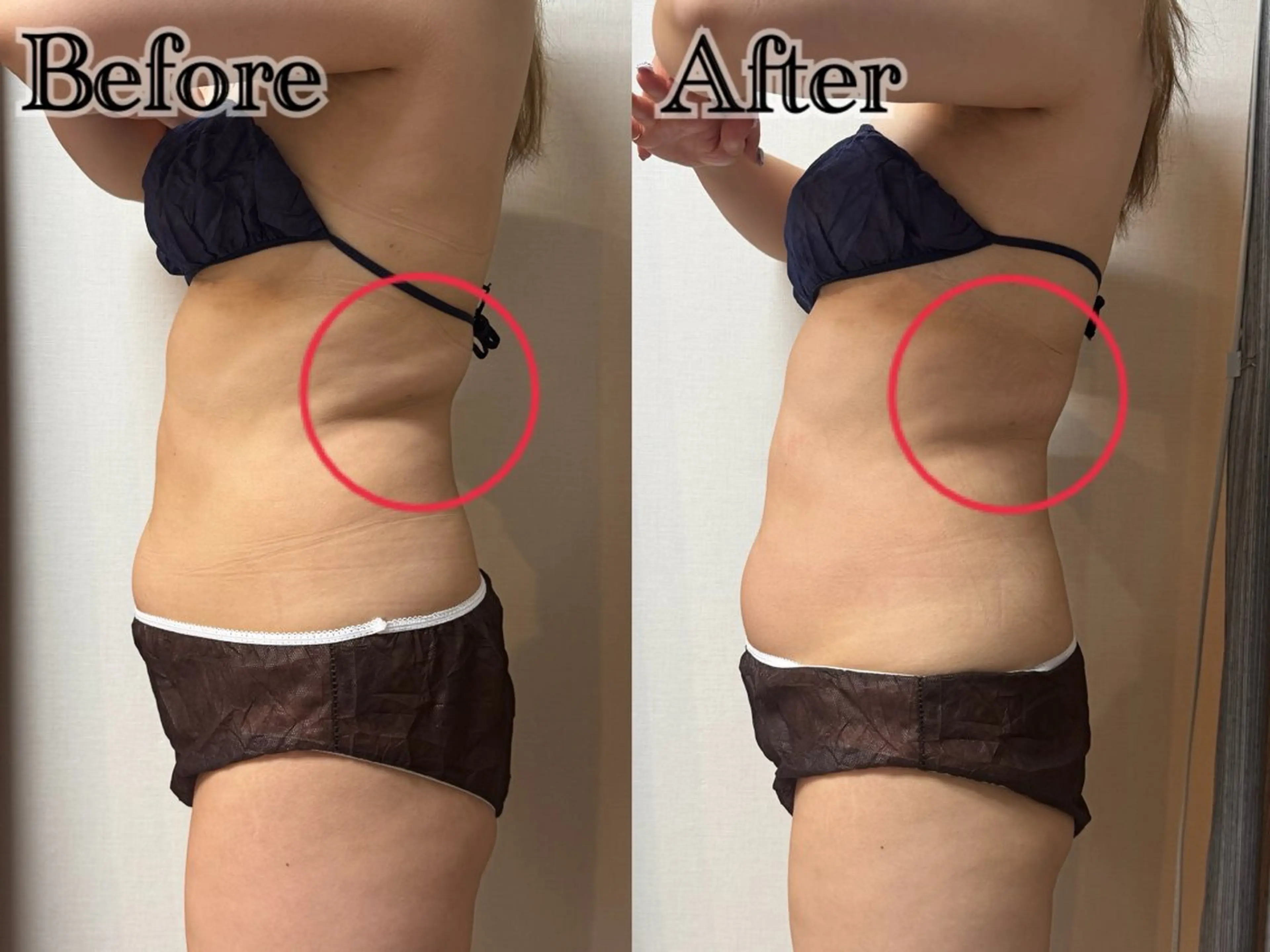 エステ 六本木脱毛andS 店長Sachiのエステ・リラクイメージ