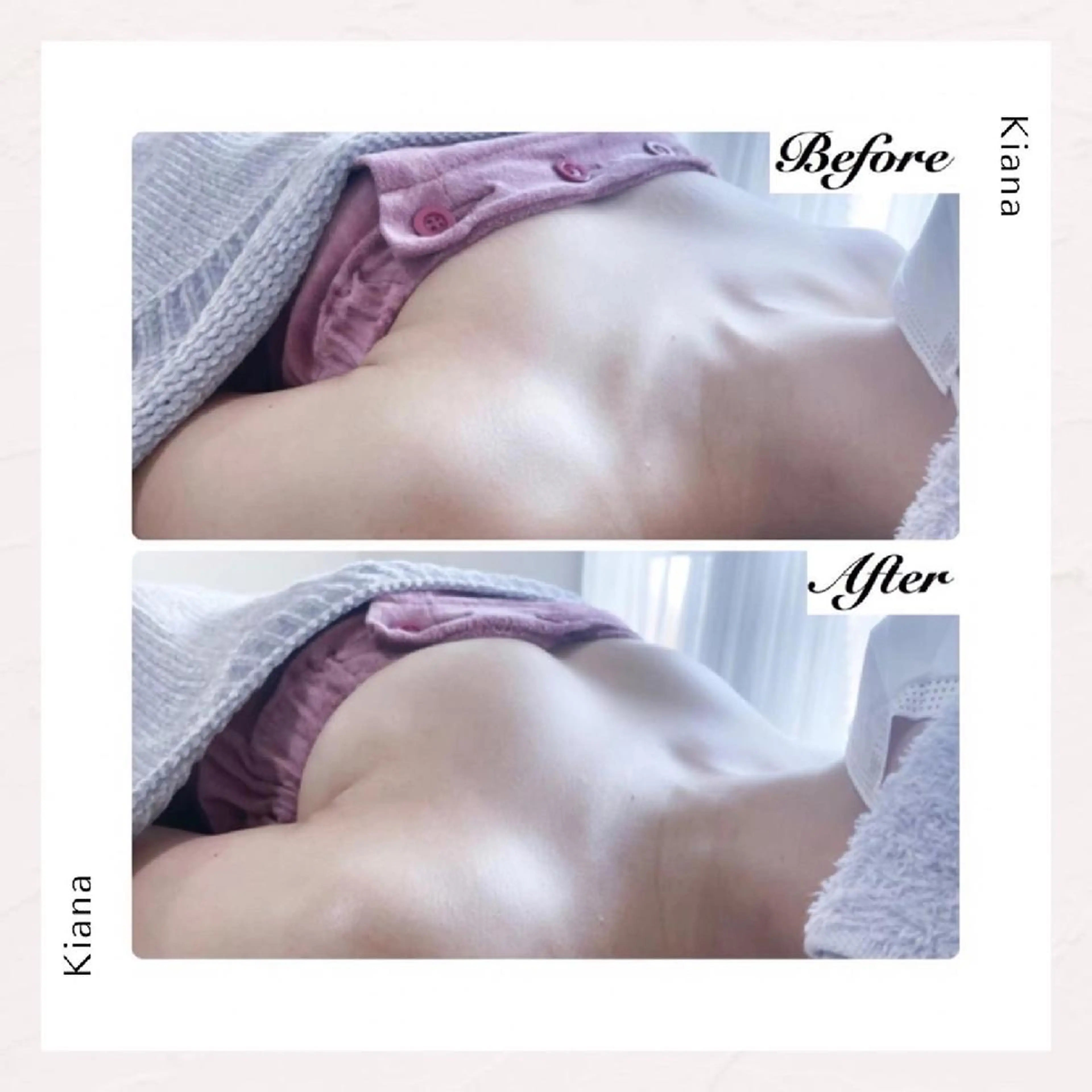 エステ リラク 【バスト専門店 】 Kiana のエステ・リラクイメージ