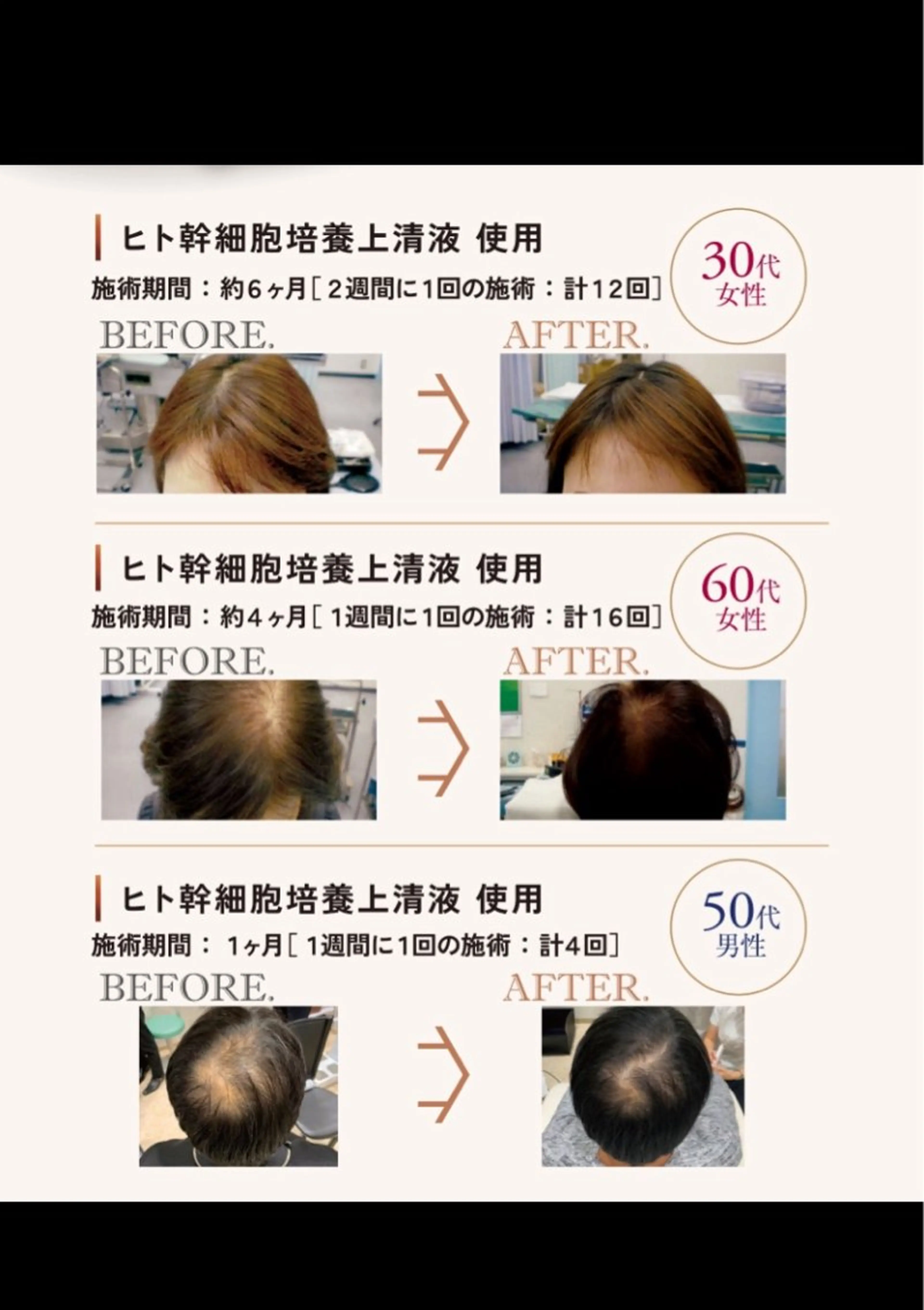 美容と育毛のサロン Link　松浦のマツエク・マツパデザイン