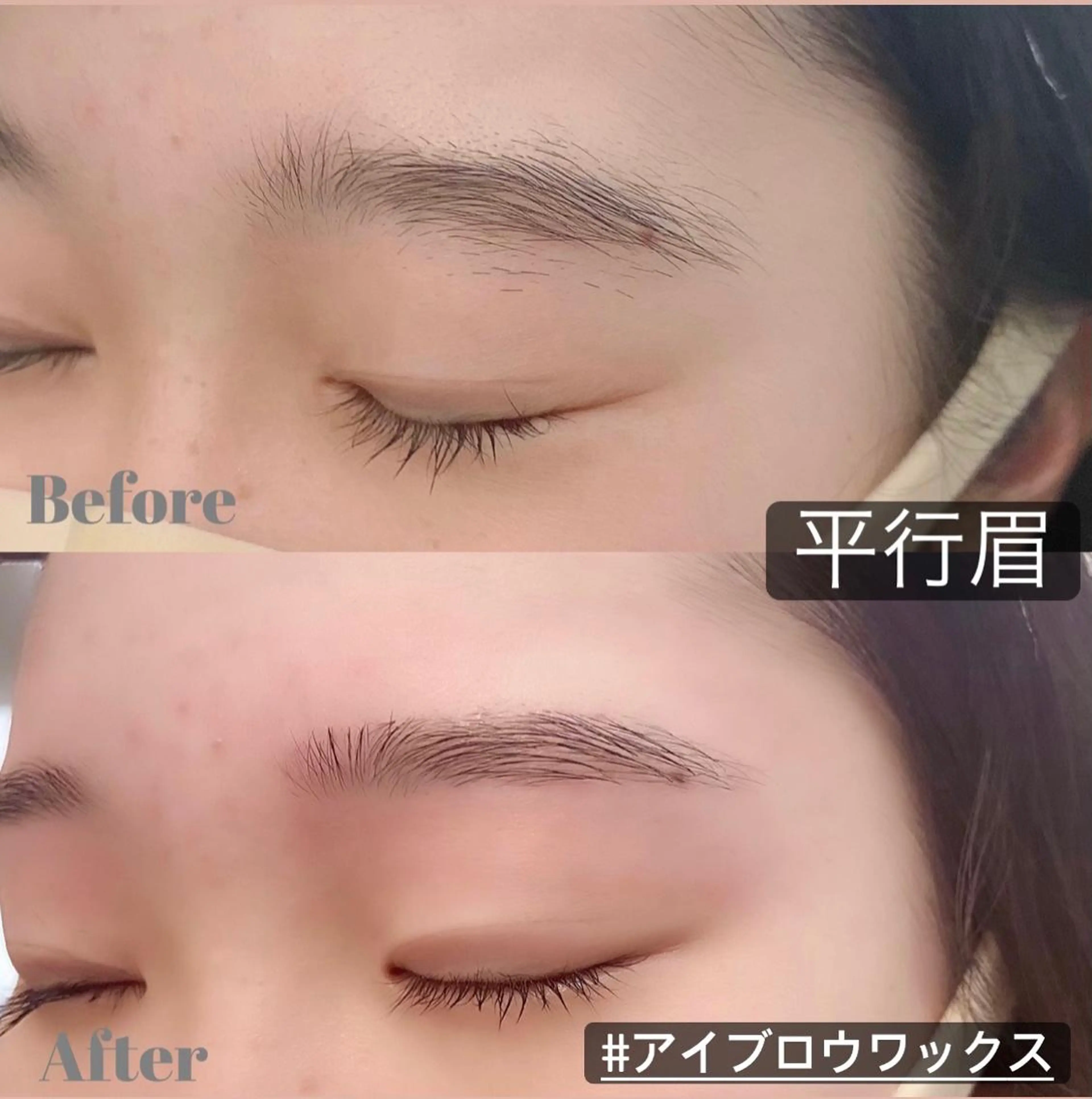 アイブロウ（眉）ワックス脱毛の写真