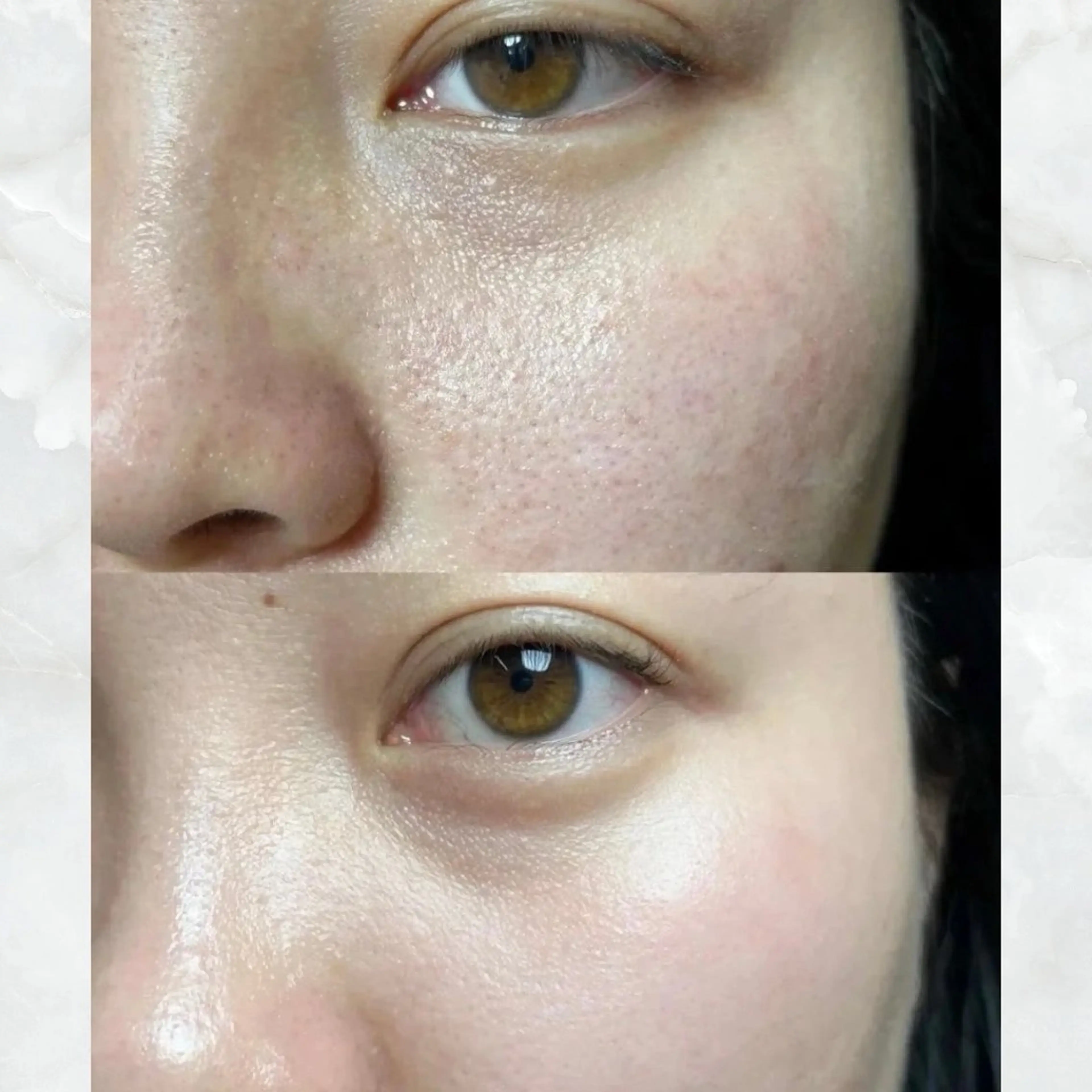 エステ リラク 愛維美水光美肌専門店 メンズレディースokのエステ・リラクイメージ