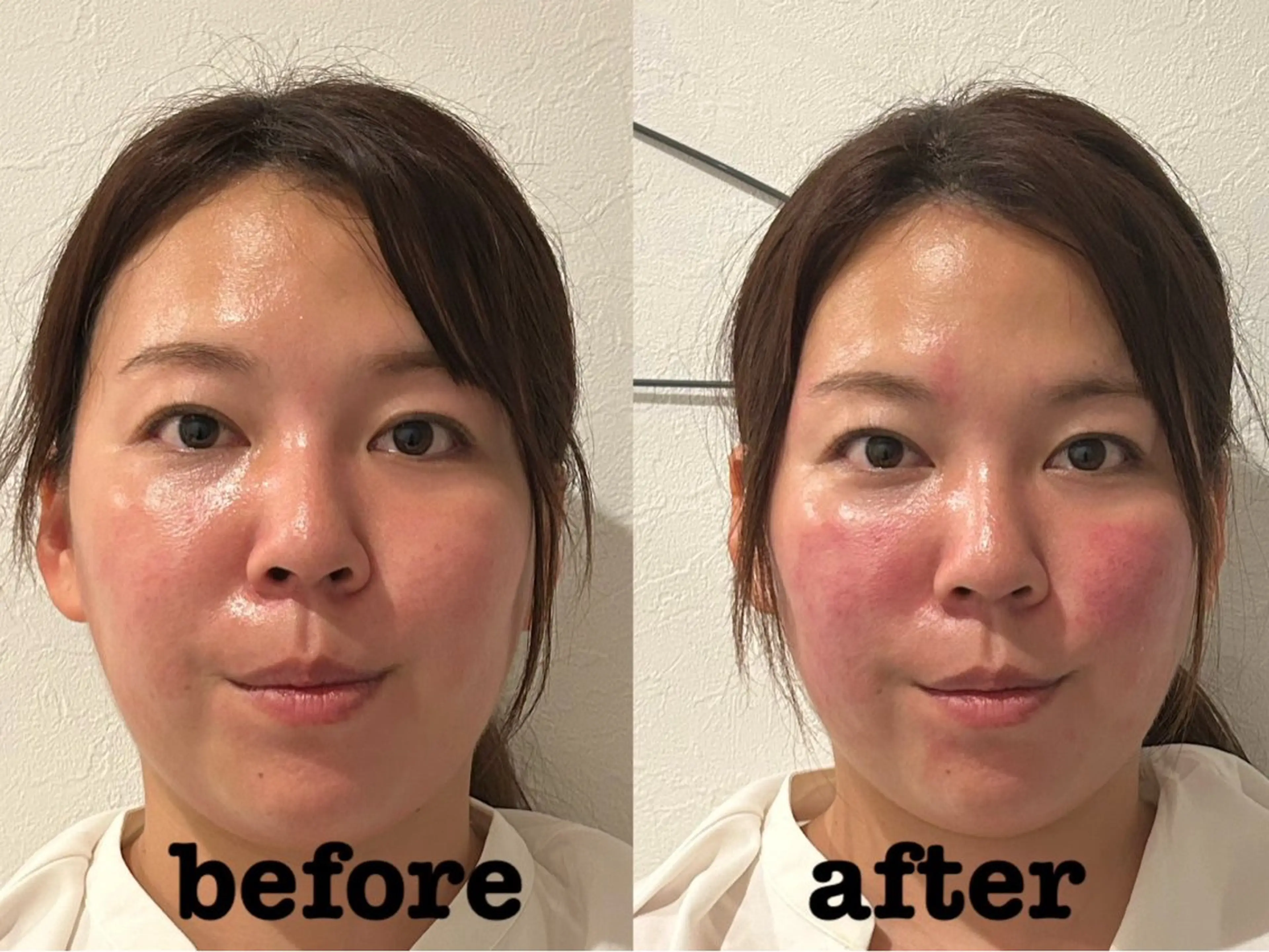 エステ リラク 美容鍼灸Solana所属・肌質改善×美容鍼 ゆいのエステ・リラクイメージ