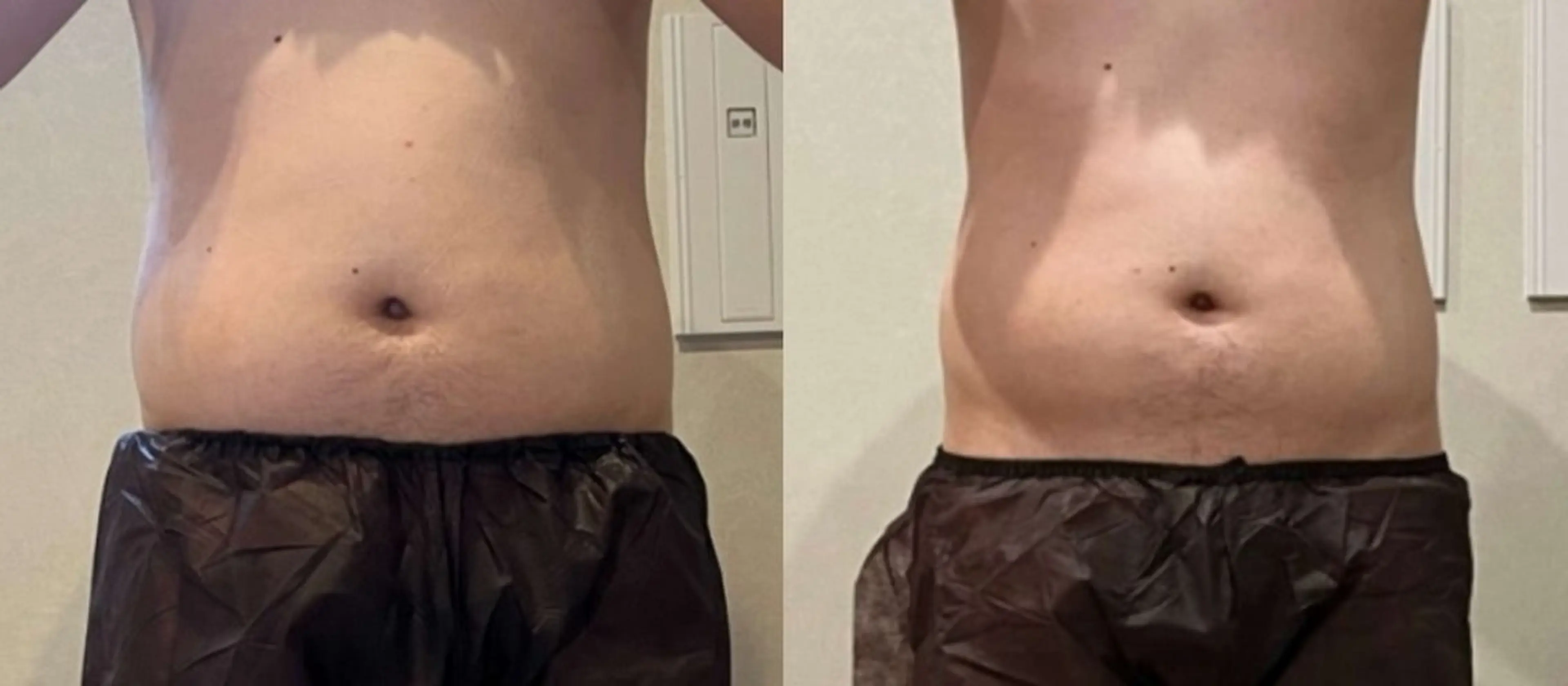 酵素風呂併設/痩身 madokaのエステ・リラクイメージ