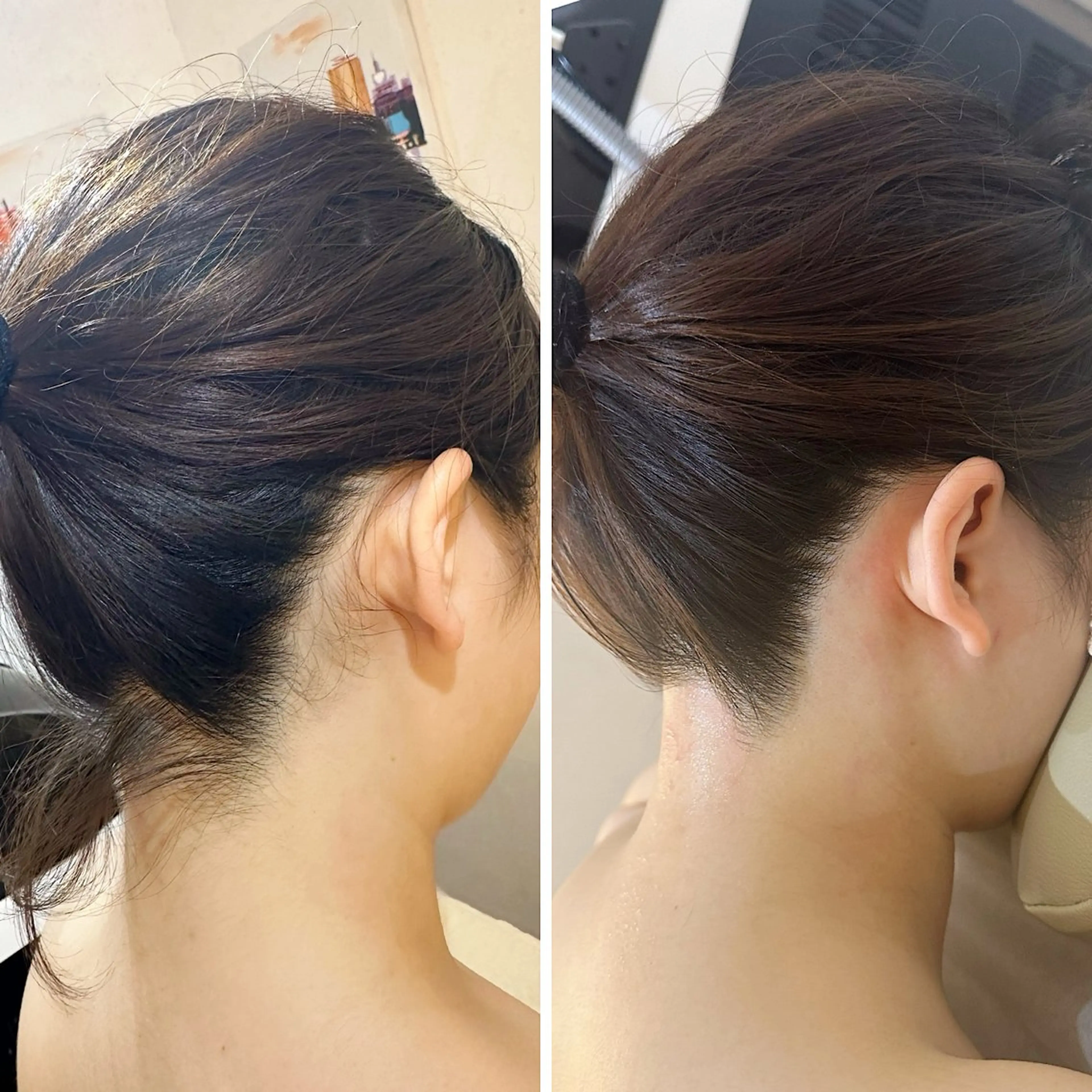 脱毛 うなじ脱毛/美肌脱毛 LABELのエステ・リラクイメージ