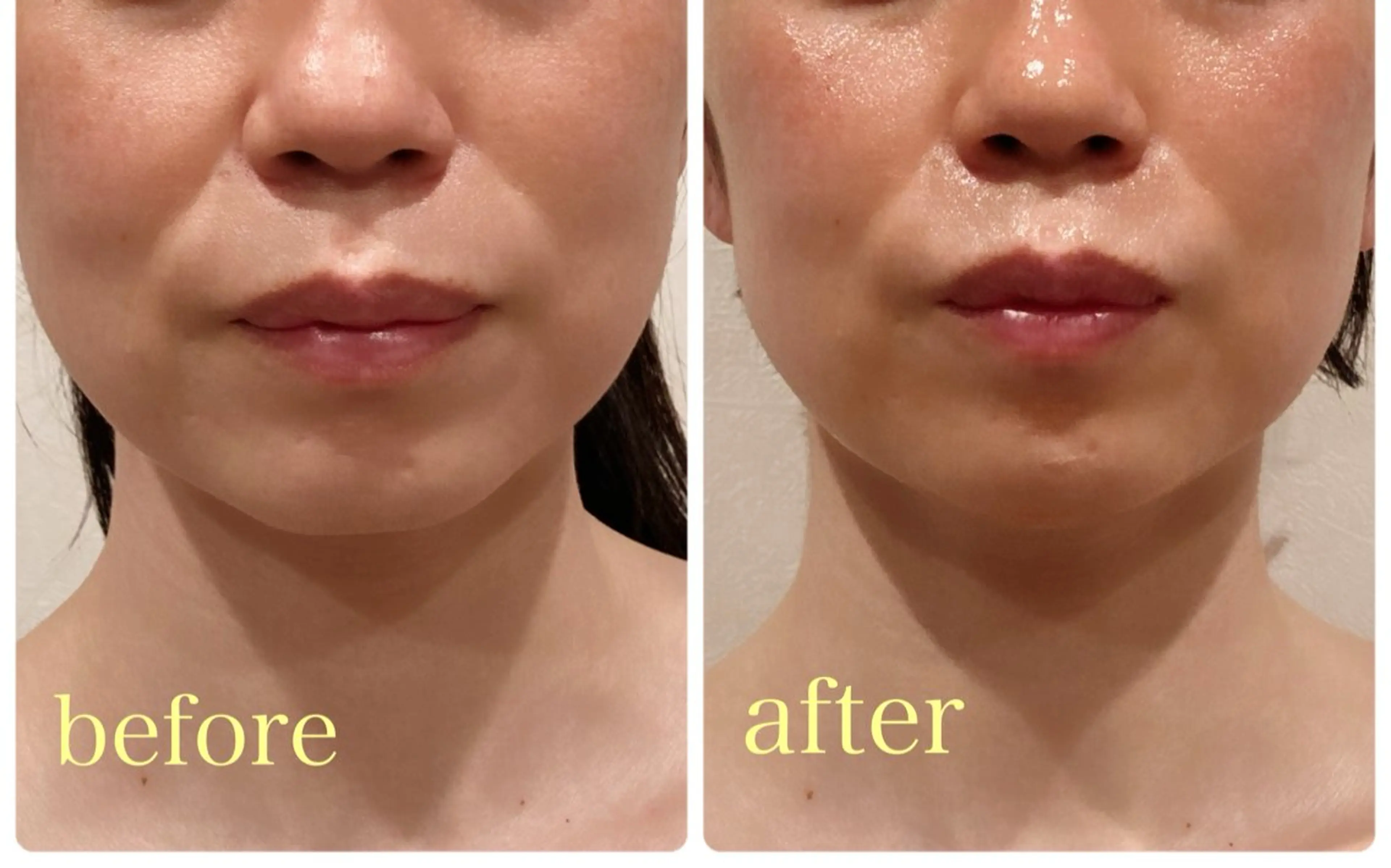 エステ リラク 小顔×肌質改善サロン soin〔ソワン〕のエステ・リラクイメージ