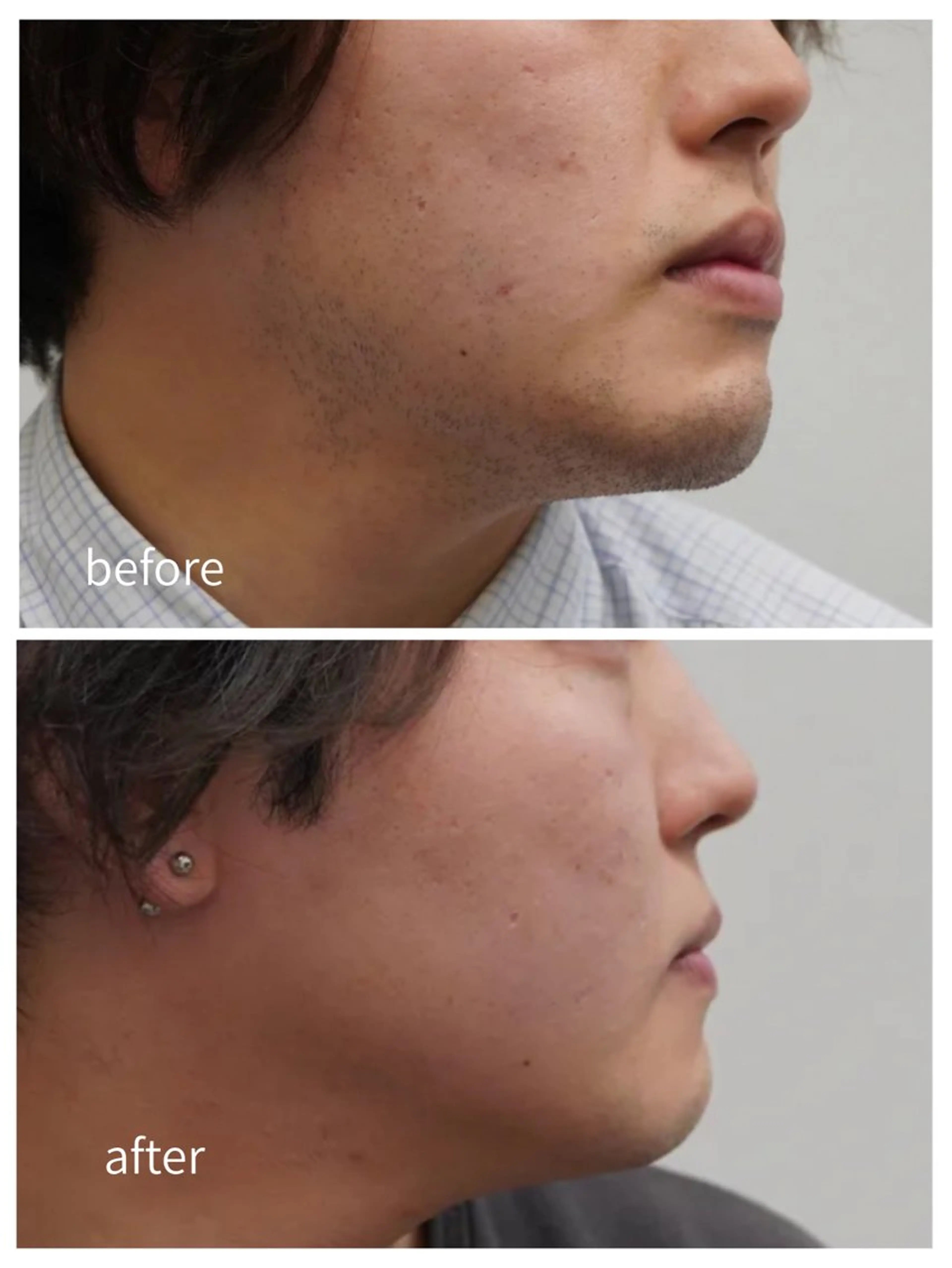 脱毛 脱毛サロン ベル・マタンのエステ・リラクイメージ