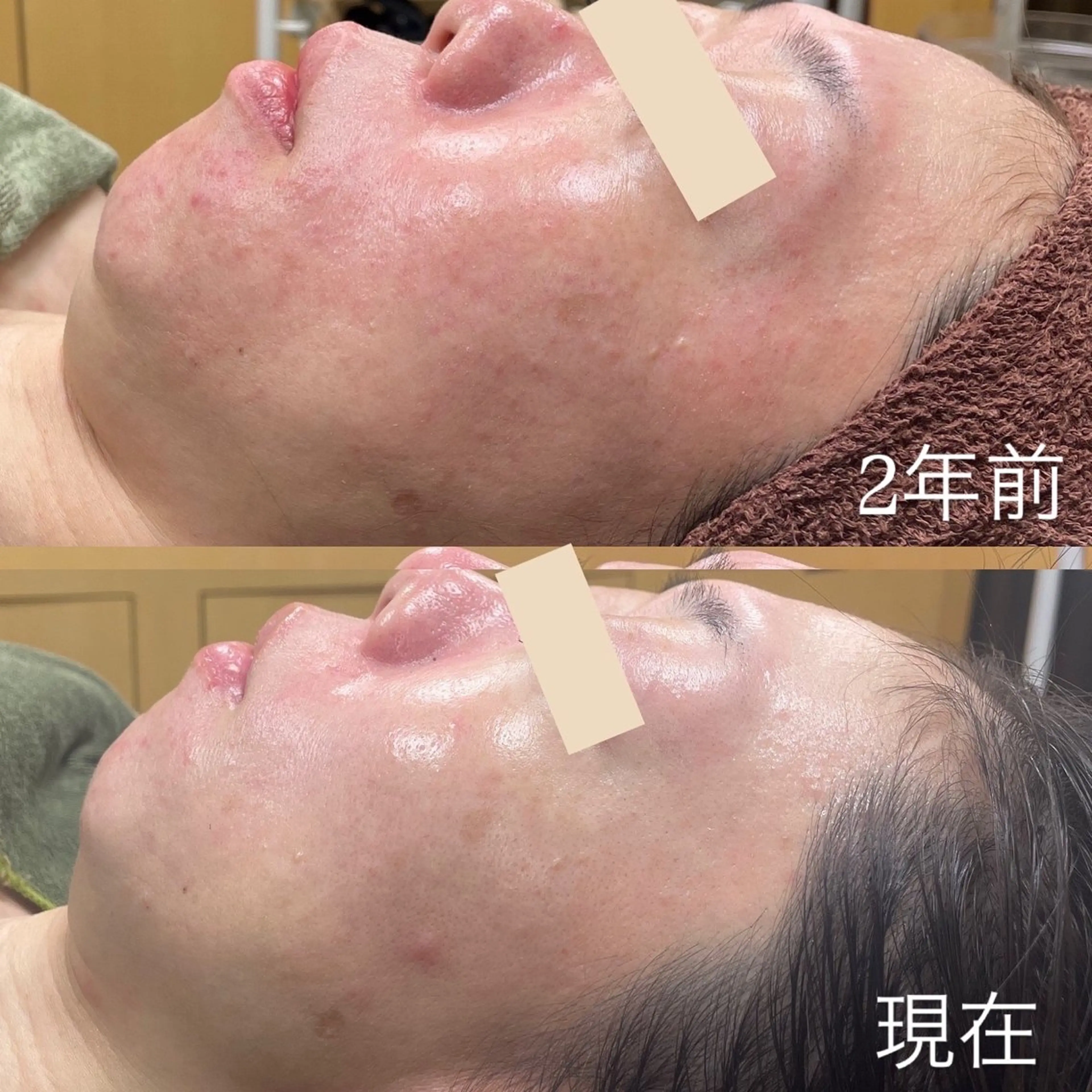 エステ 吉井 奈緒美のマツエク・マツパデザイン