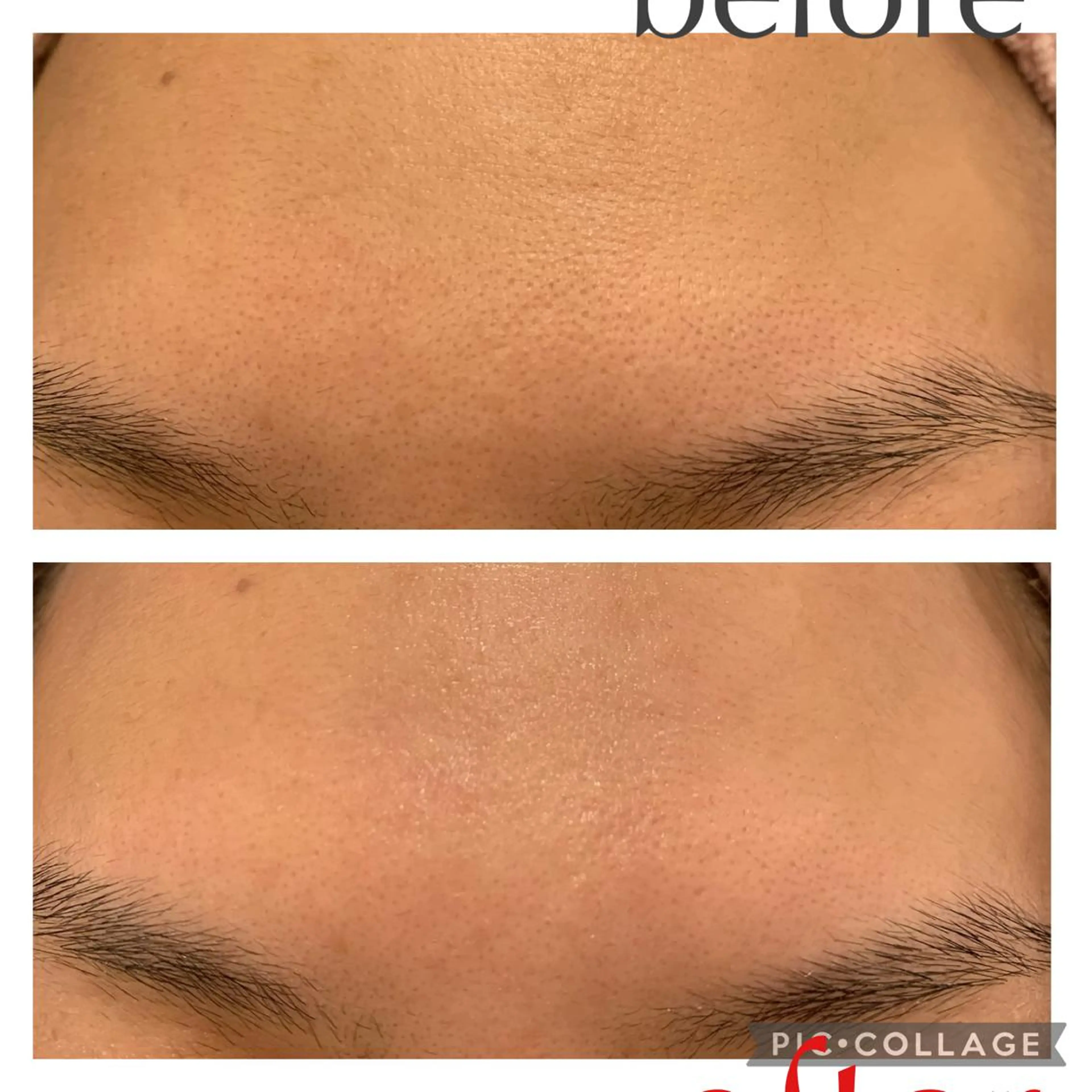 Lino Uのネイルデザイン