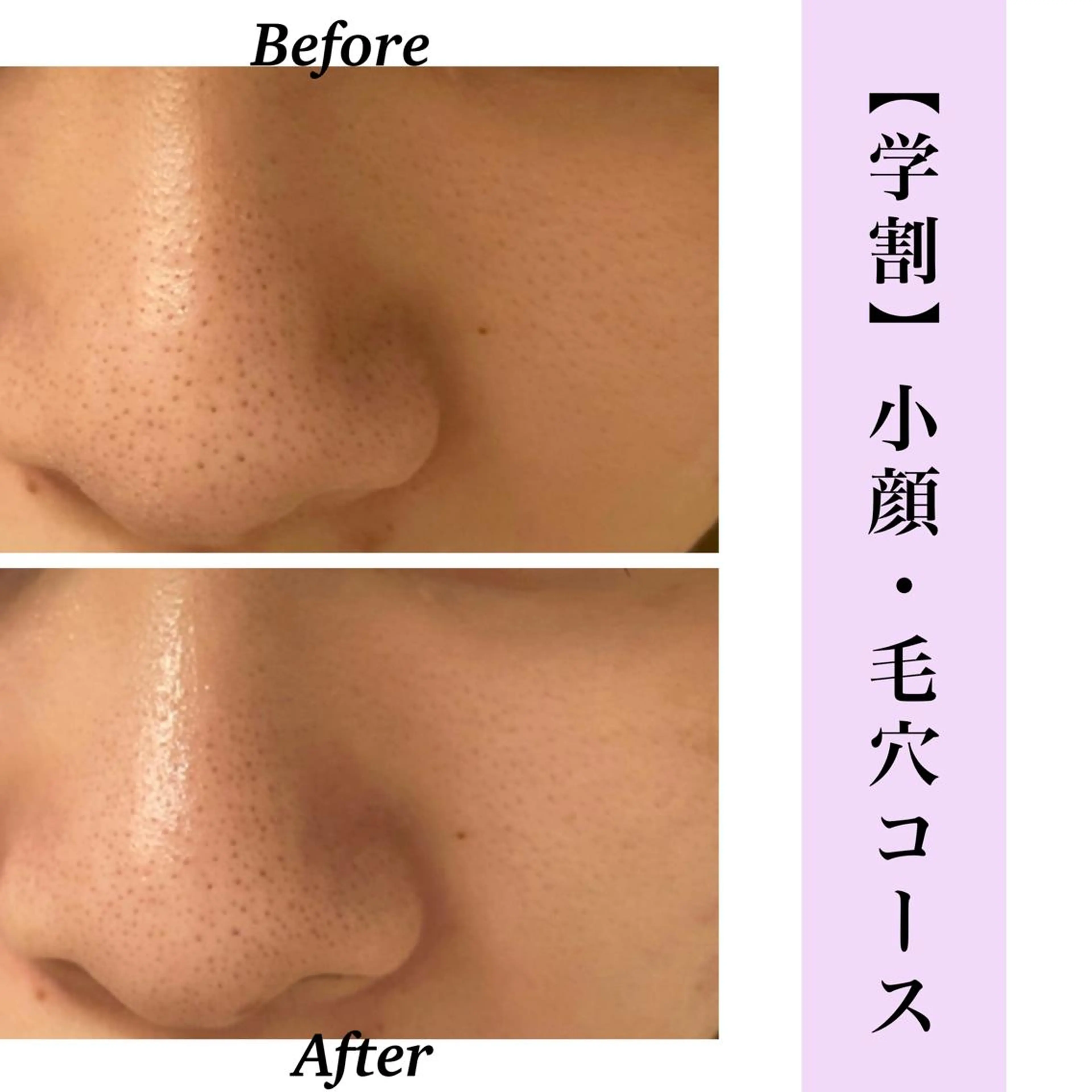 Bellesthe （ベルエステ）のエステ・リラクイメージ