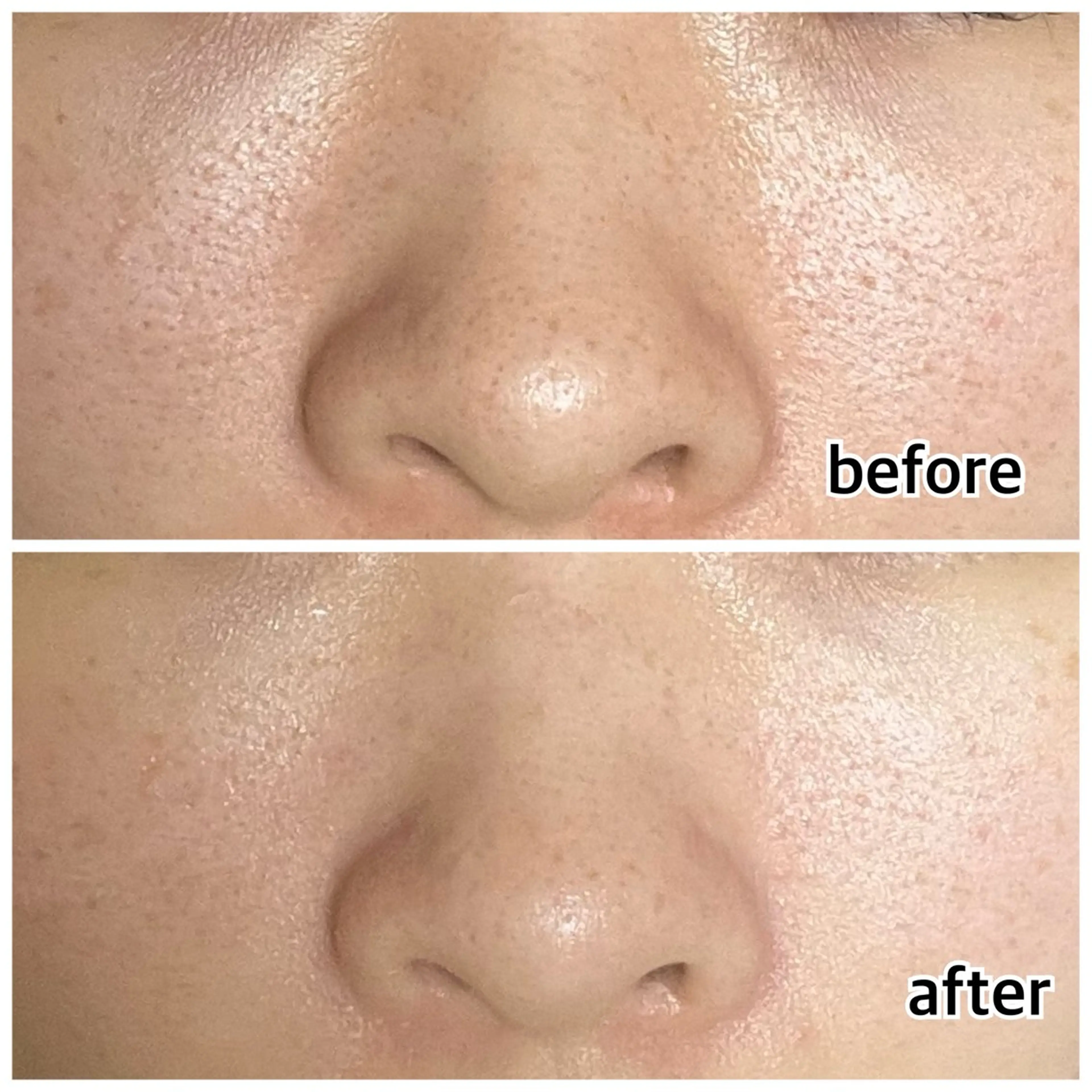 エステ リラク ビューティーサロン シャルルーズのエステ・リラクイメージ