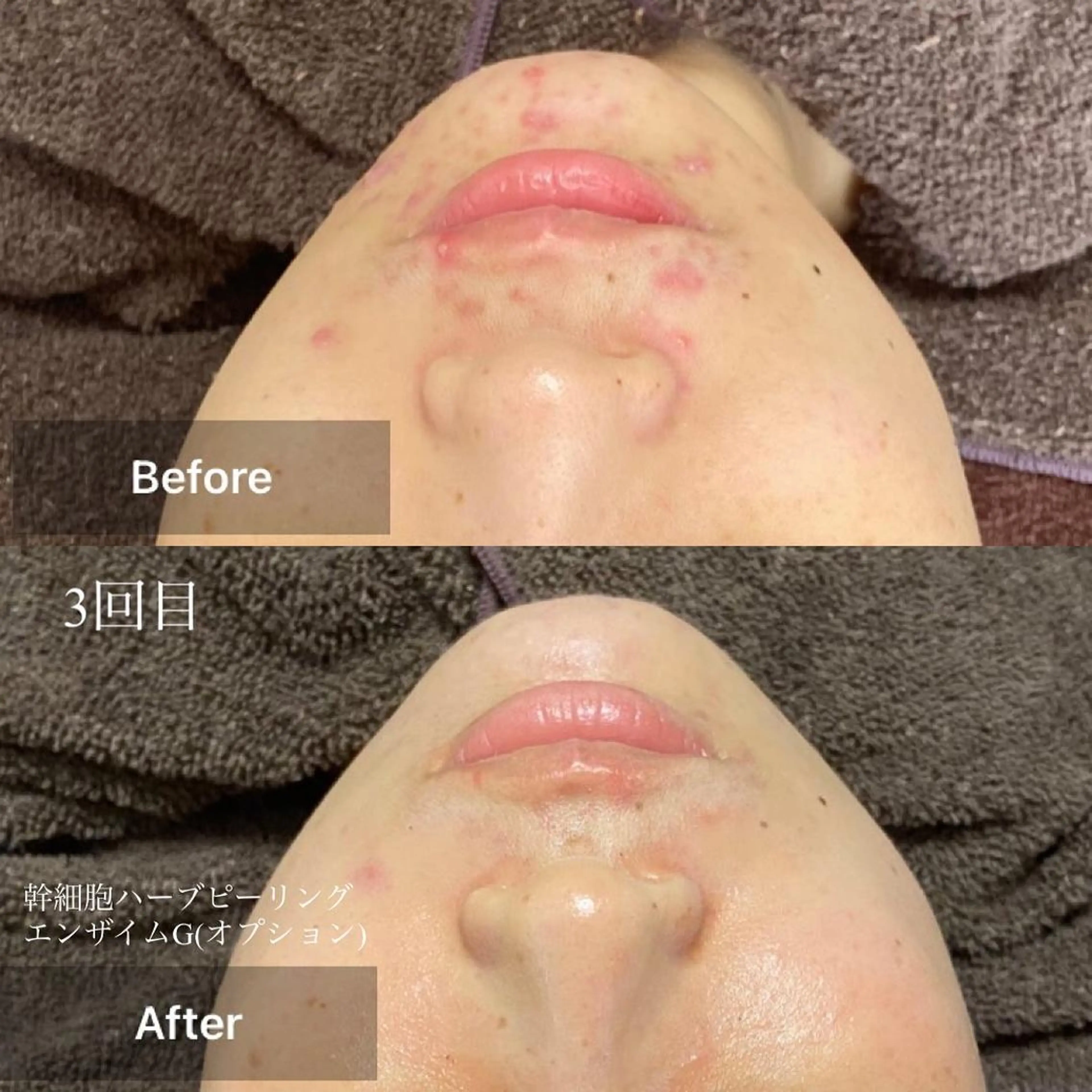 メンズ キッズ エステ 美肌と癒しのサロン Lu,Mieのエステ・リラクイメージ