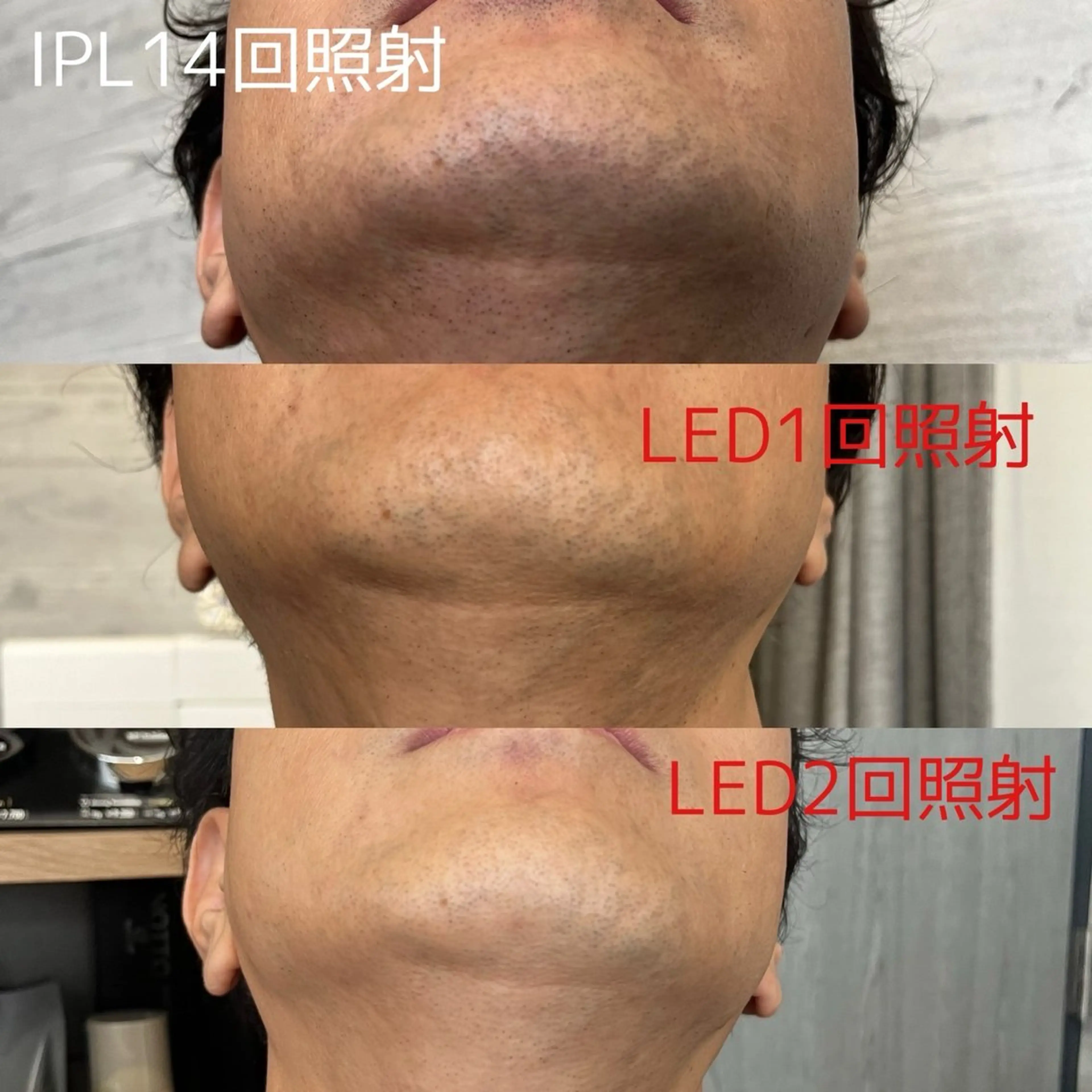 脱毛 篠原 由紀野のエステ・リラクイメージ