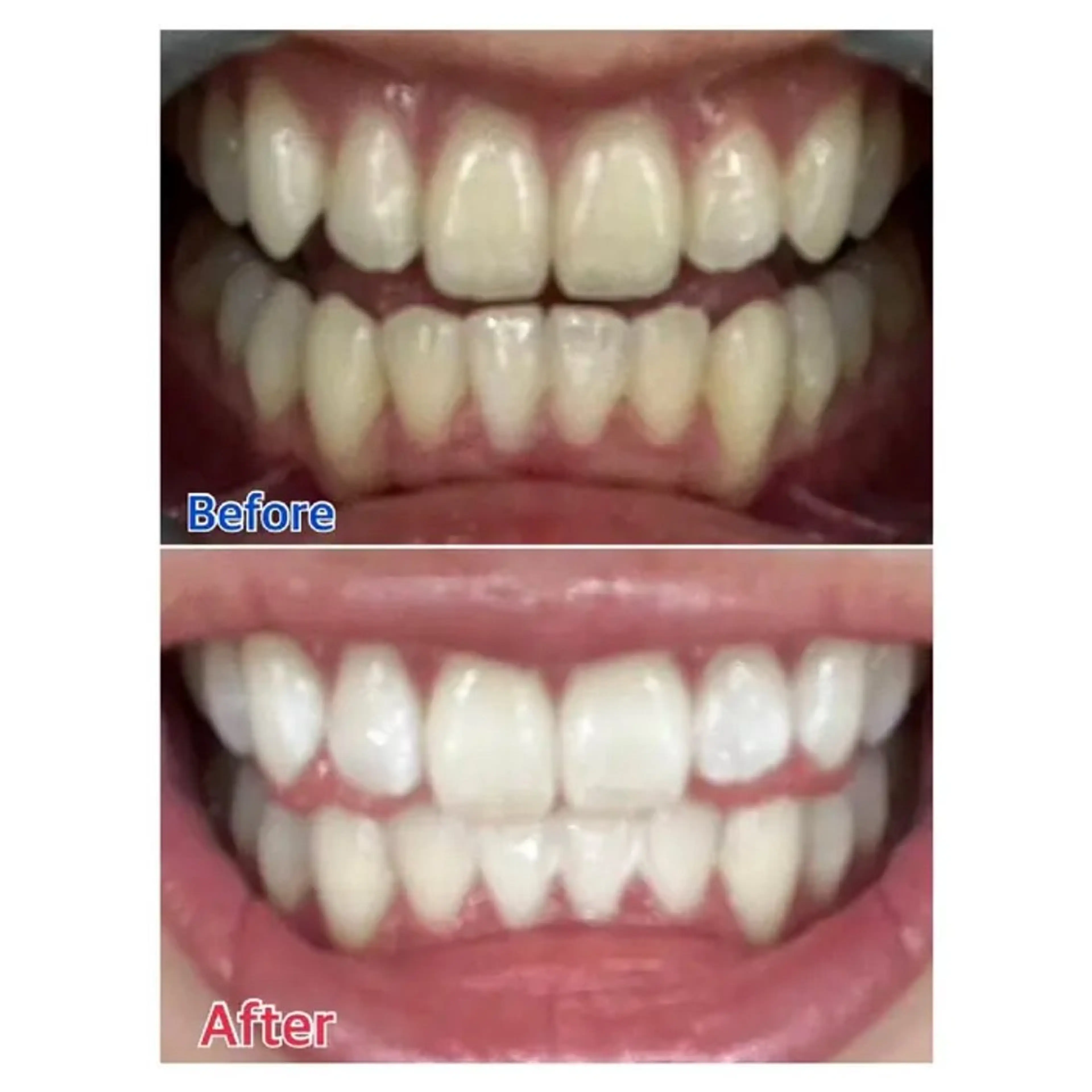 M渋谷 ホワイトニングのエステ・リラクイメージ