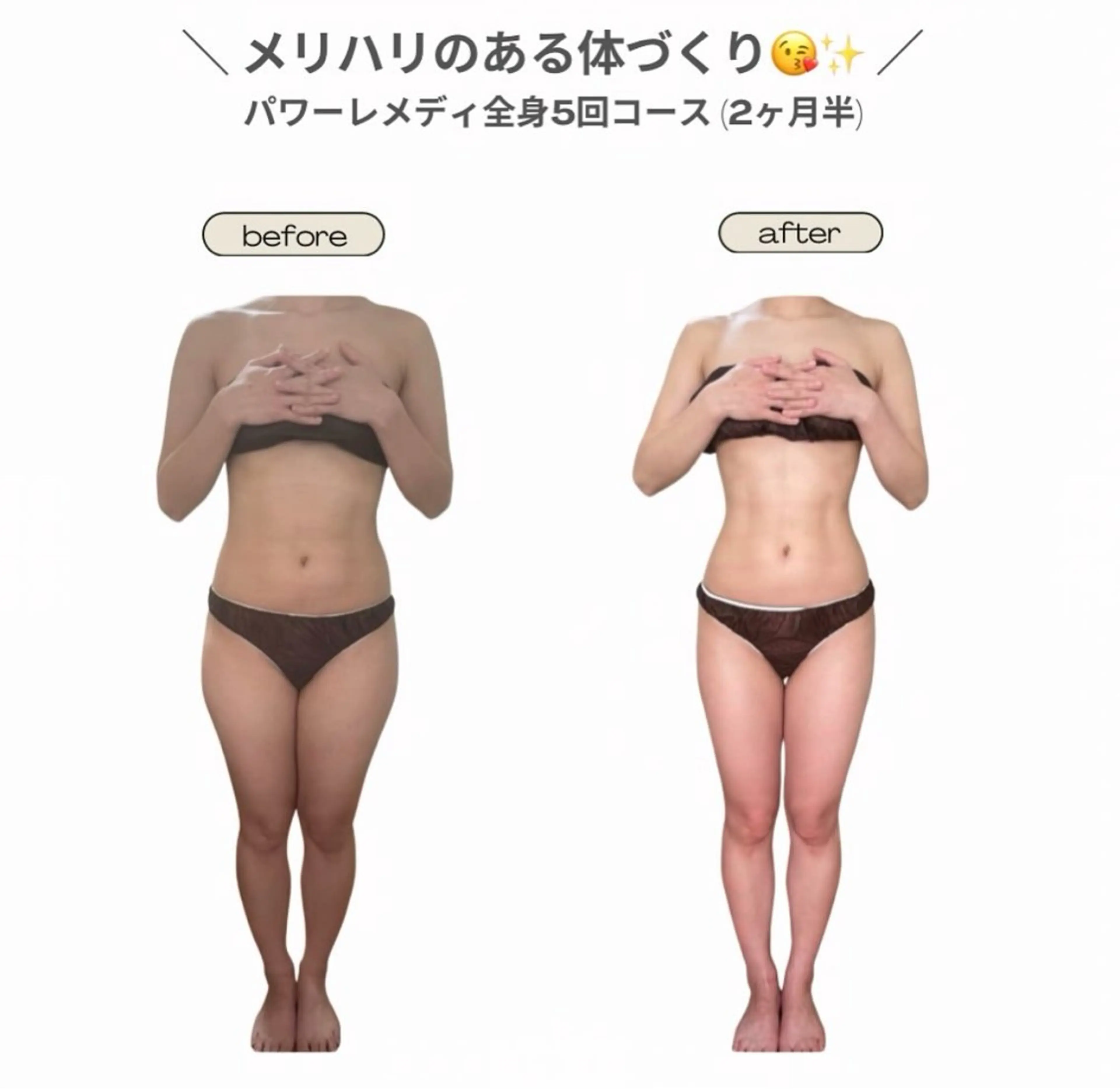 エステ リラク 《本気痩せ×疲労改善 》  BILOOPのエステ・リラクイメージ
