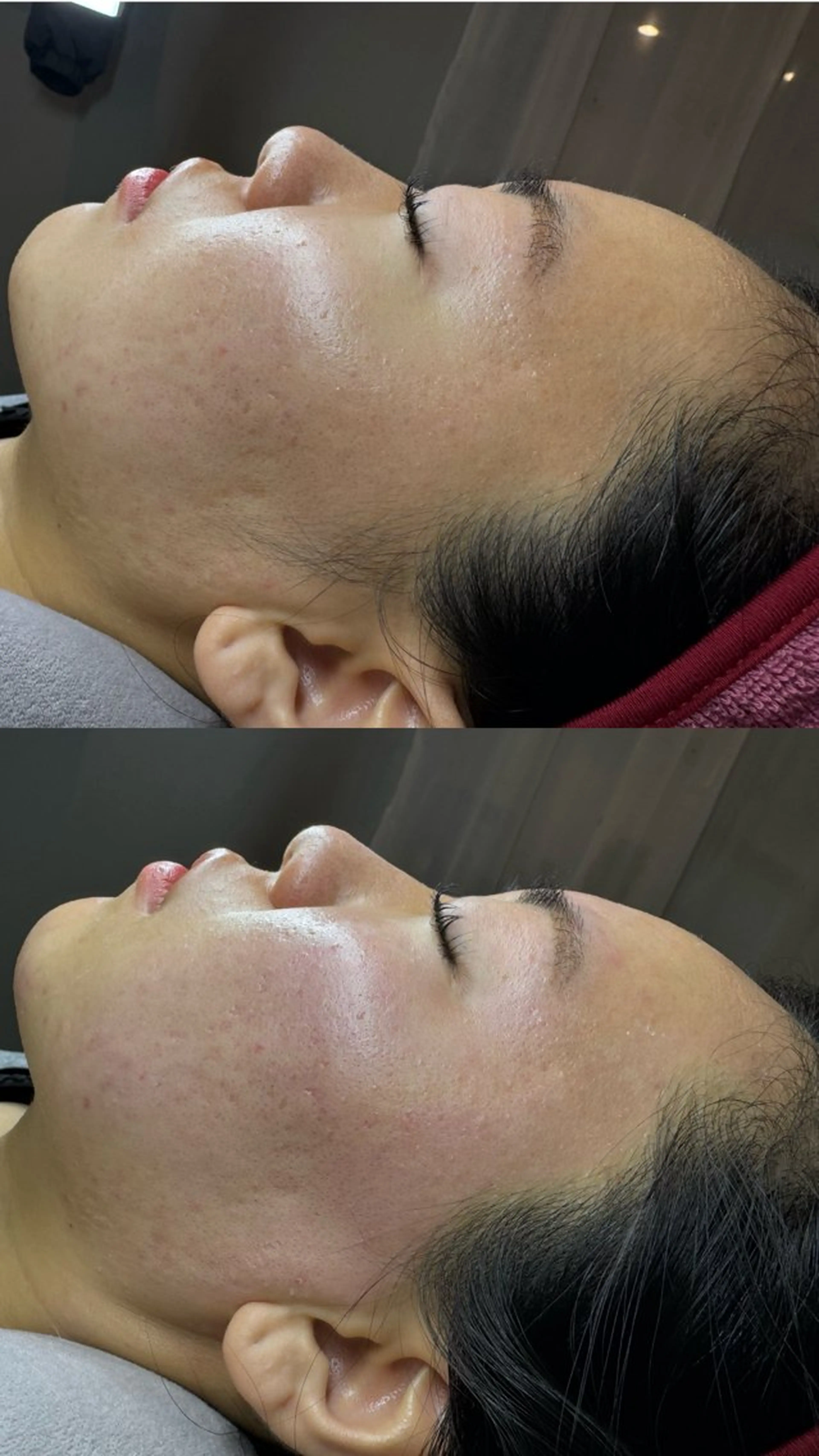 エステ 韓国肌管理HARRY ・ハリー🤍大村のエステ・リラクイメージ