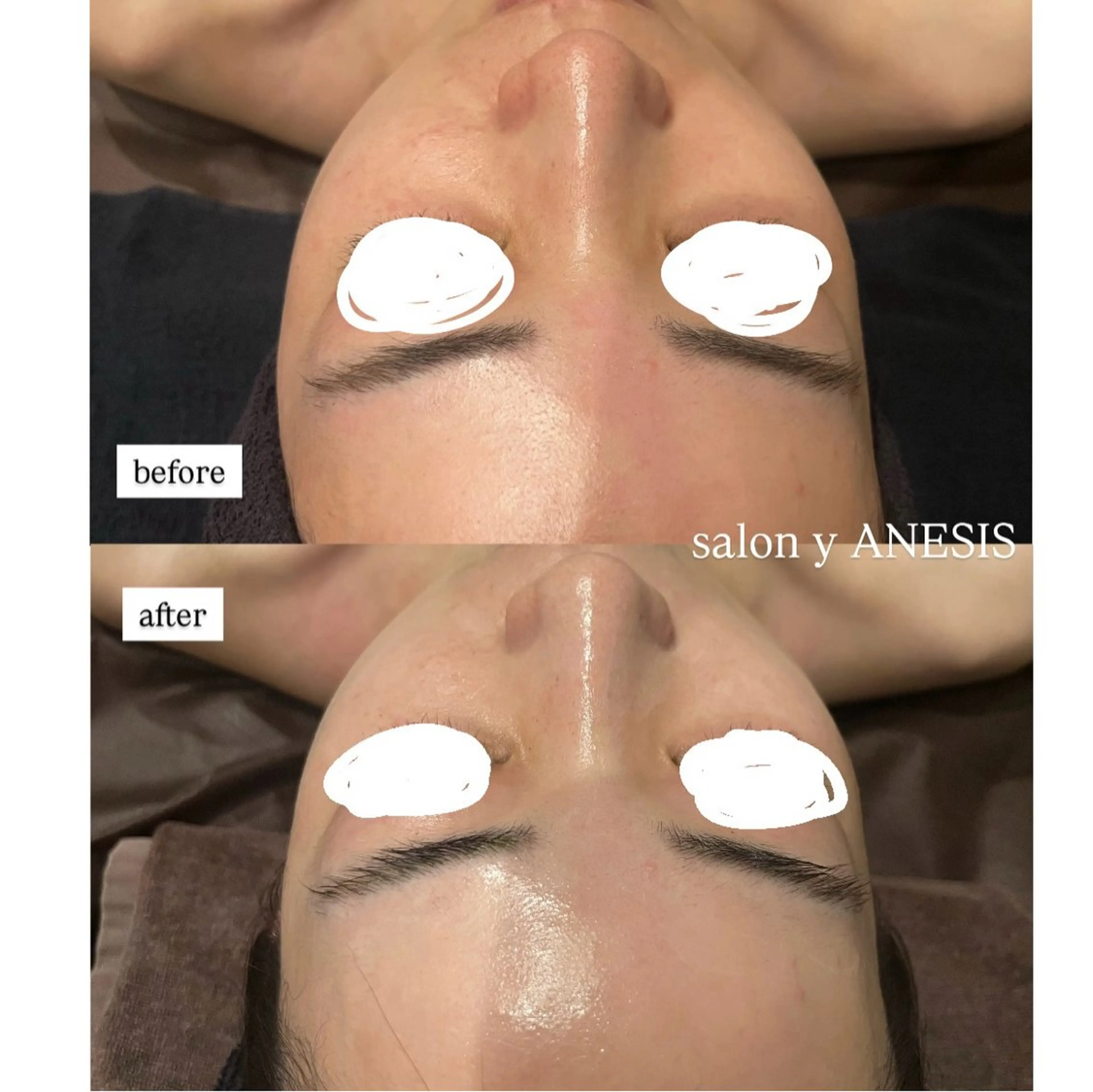 [結果重視✨] Reviハーブ2g➕オプション2種💎(デコルテ付)60分の写真