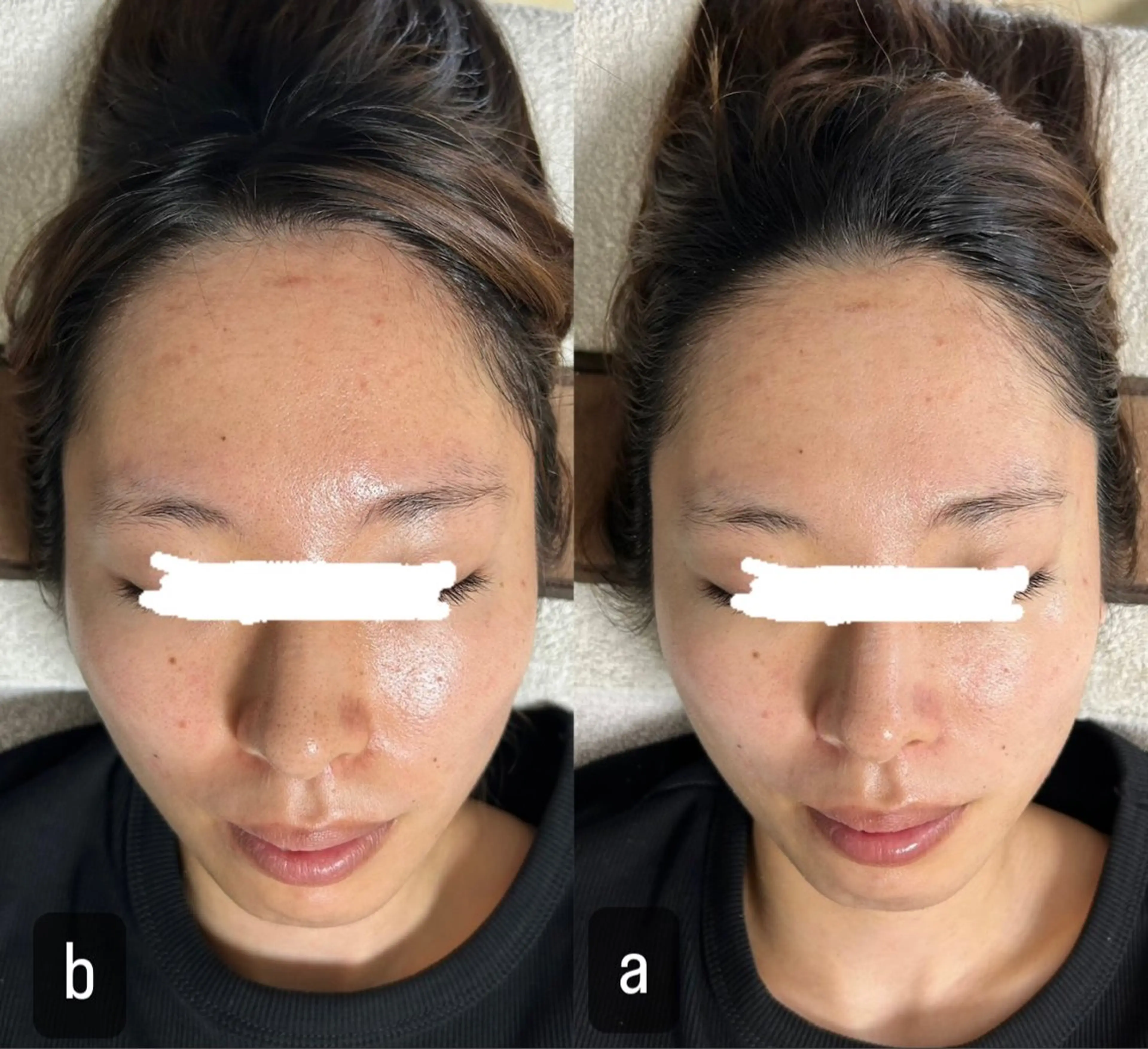 217 ホワイトニングルームのエステ・リラクイメージ