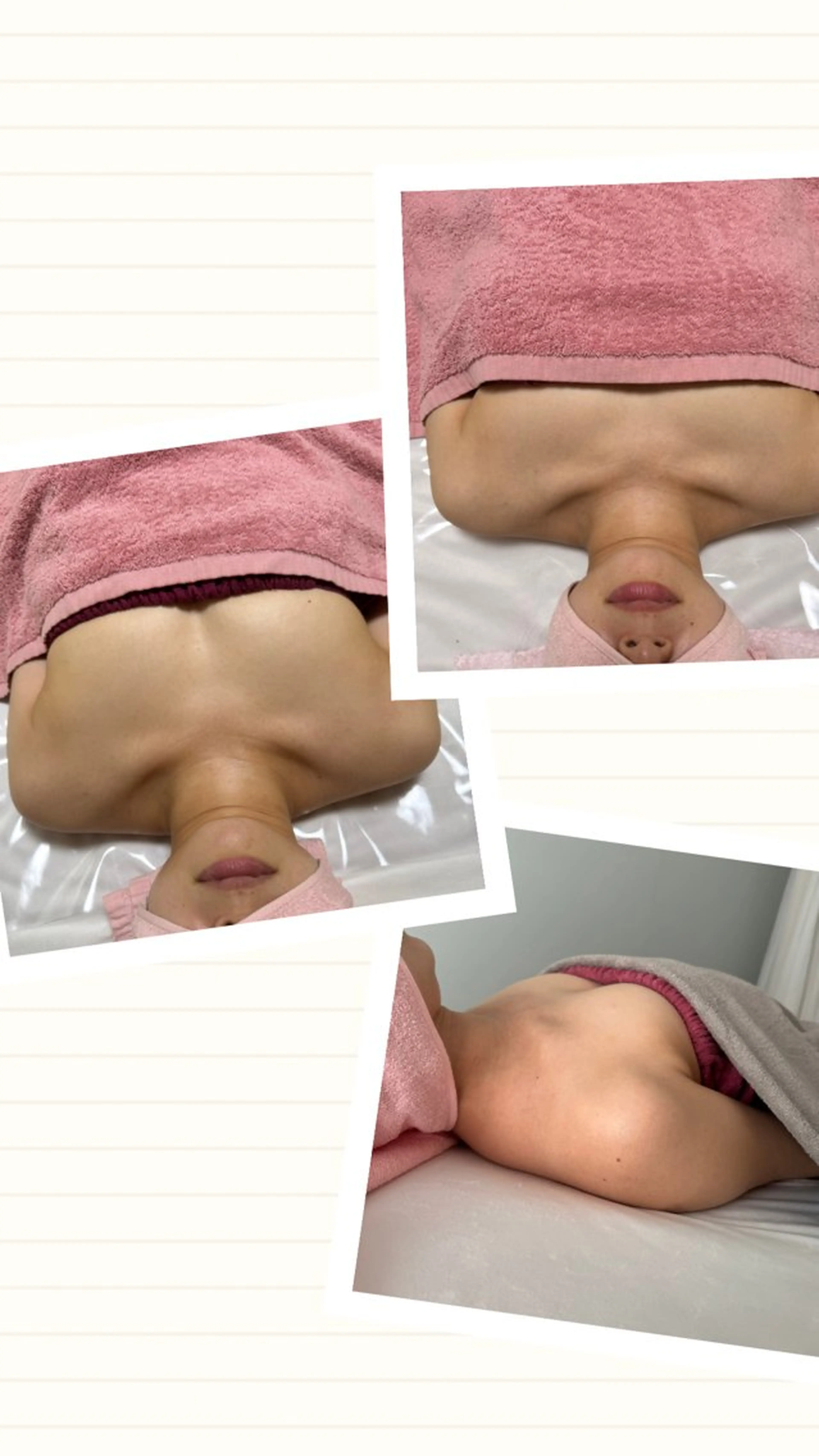 ハリ×弾力アップ！バストアップ、エラスチンの写真