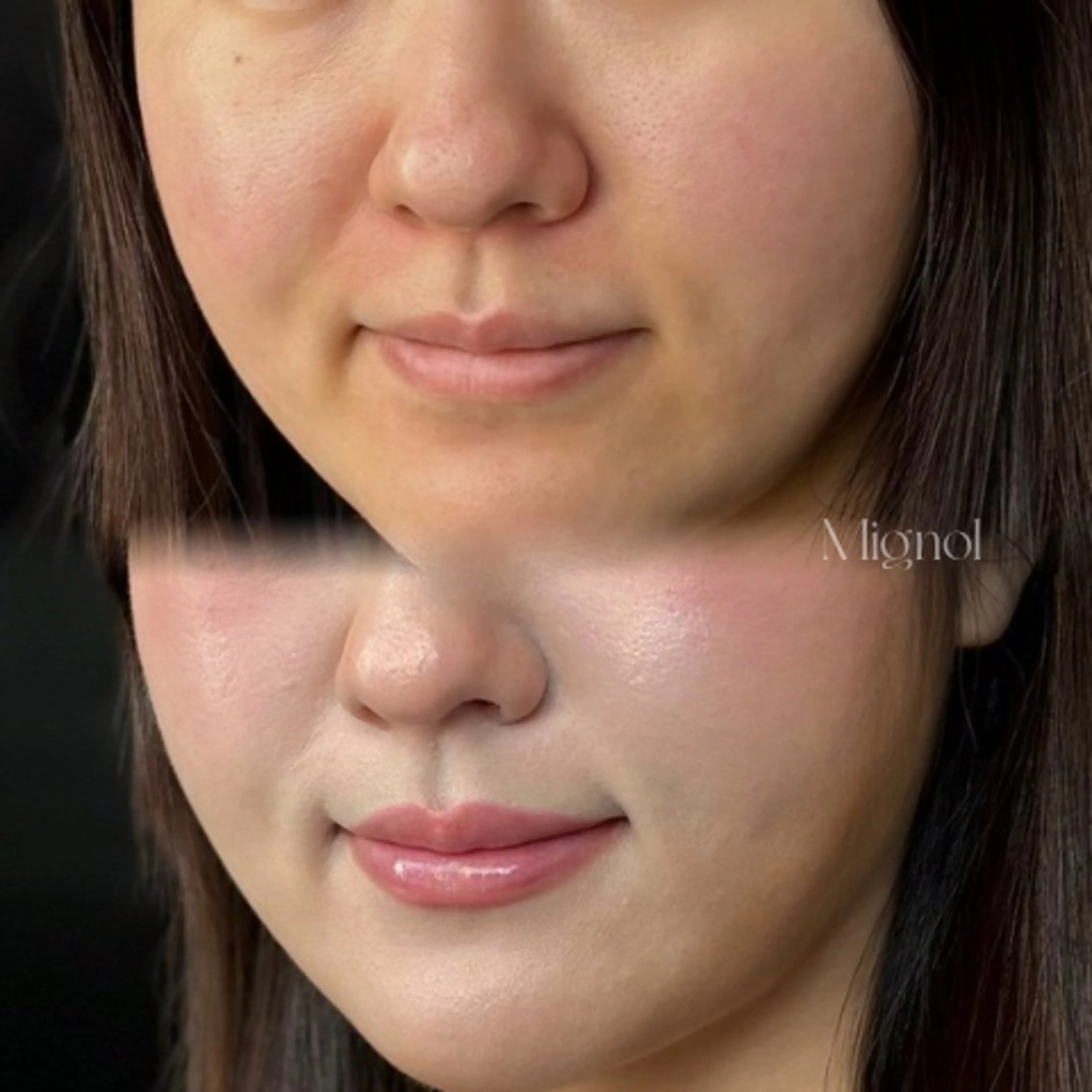 パーソナルカラー診断 骨格診断 顔タイプ診断 yuri | 韓国垢抜け🌙のその他イメージ