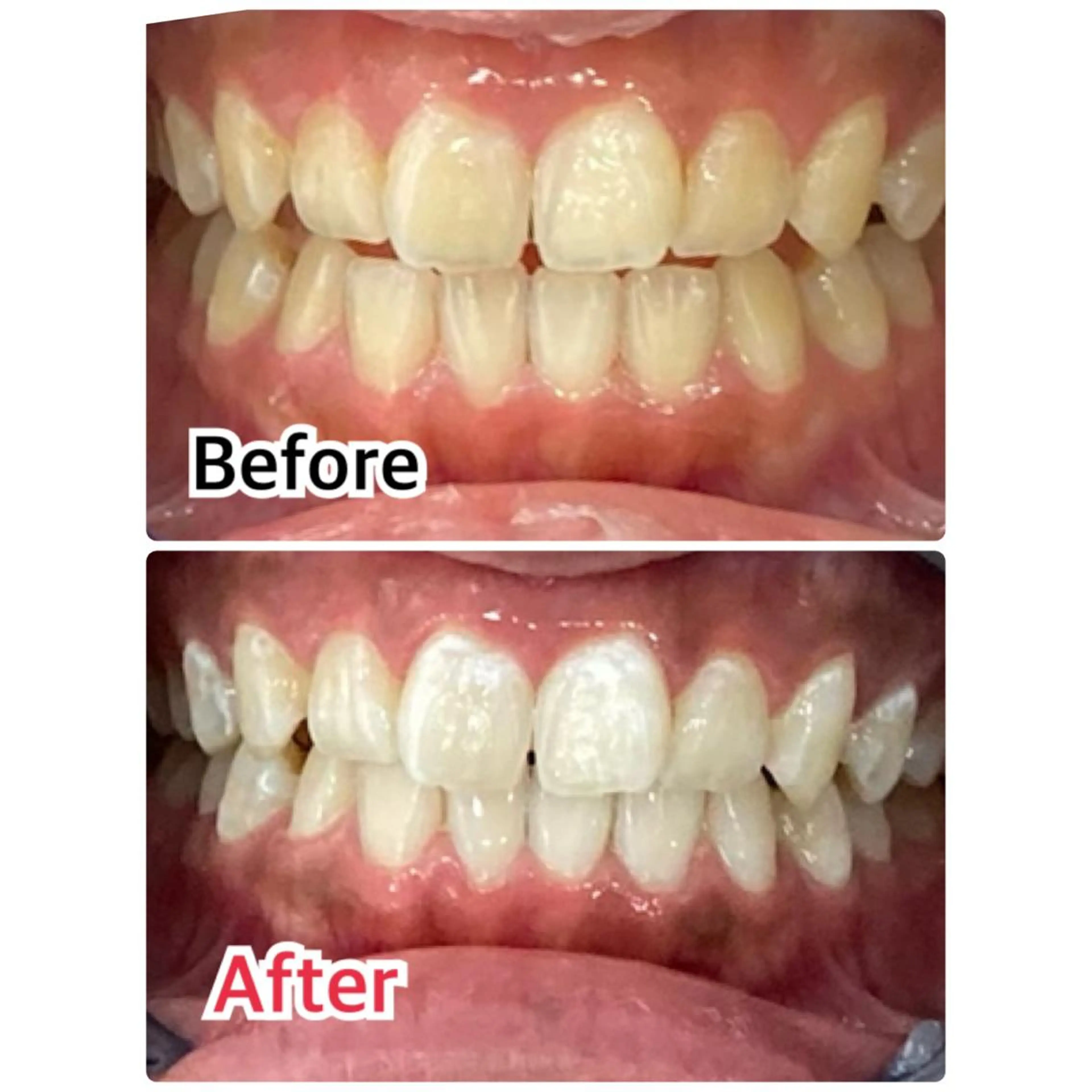 【歯科提携】柏ホワイ トニングスタイルのその他イメージ