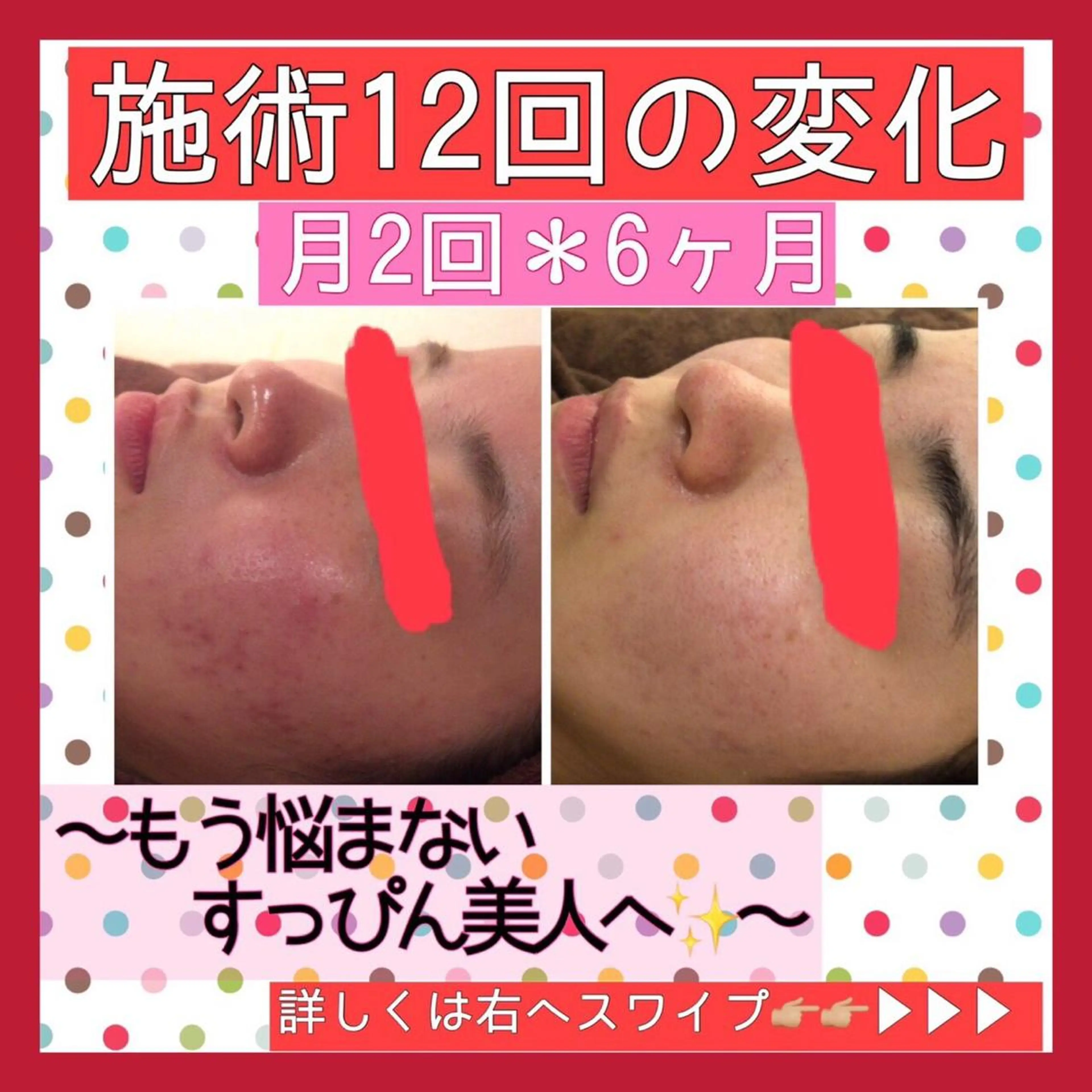 ミディアム カラー パーマ ヘアアレンジ メンズ キッズ ネイル マツエク・マツパ ニキビ・肌質改善専門 ♡人生が変わるサロンのエステ・リラクイメージ