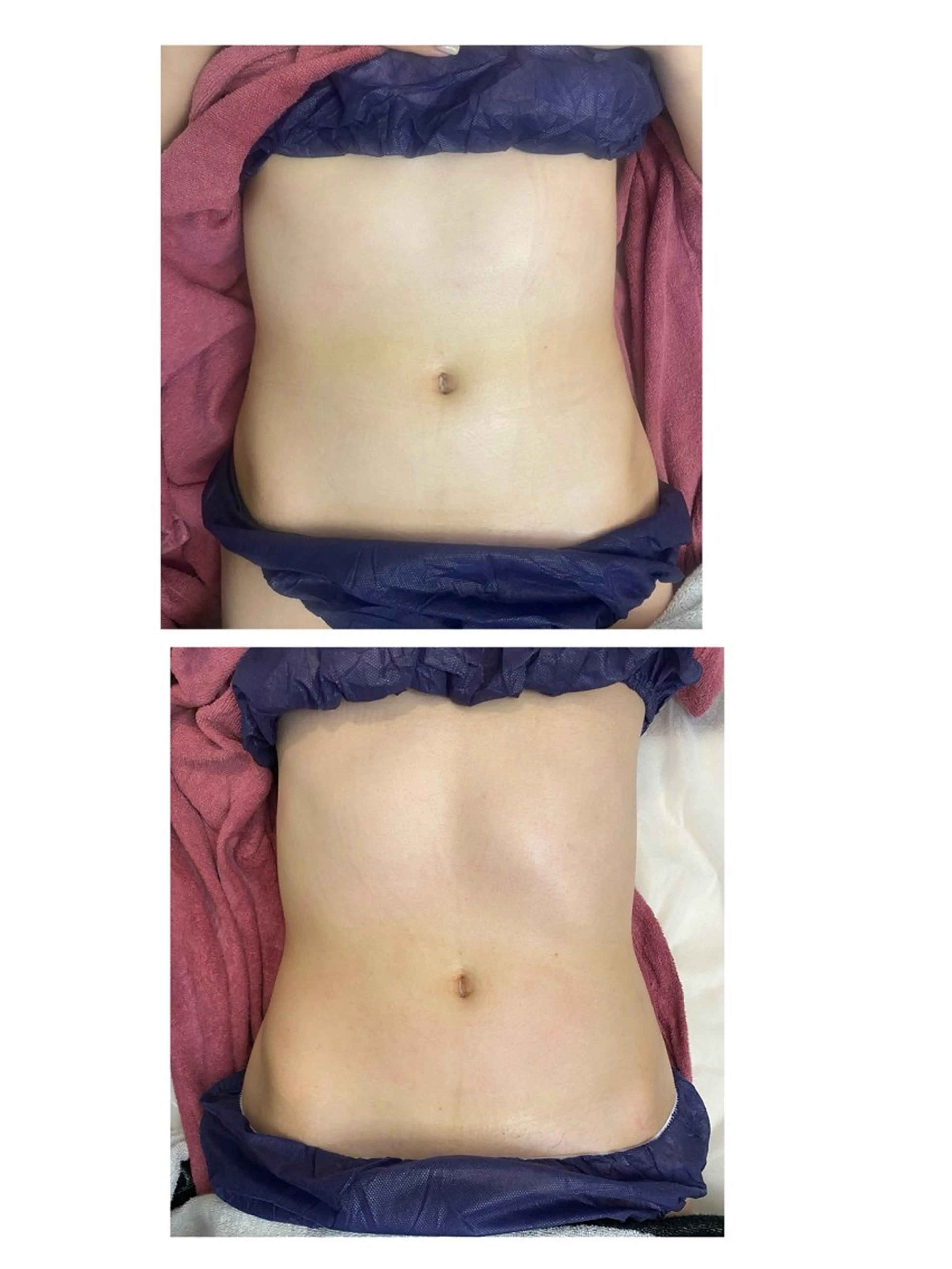 エステ リラク 脱毛・エステサロン LuLuNのエステ・リラクイメージ