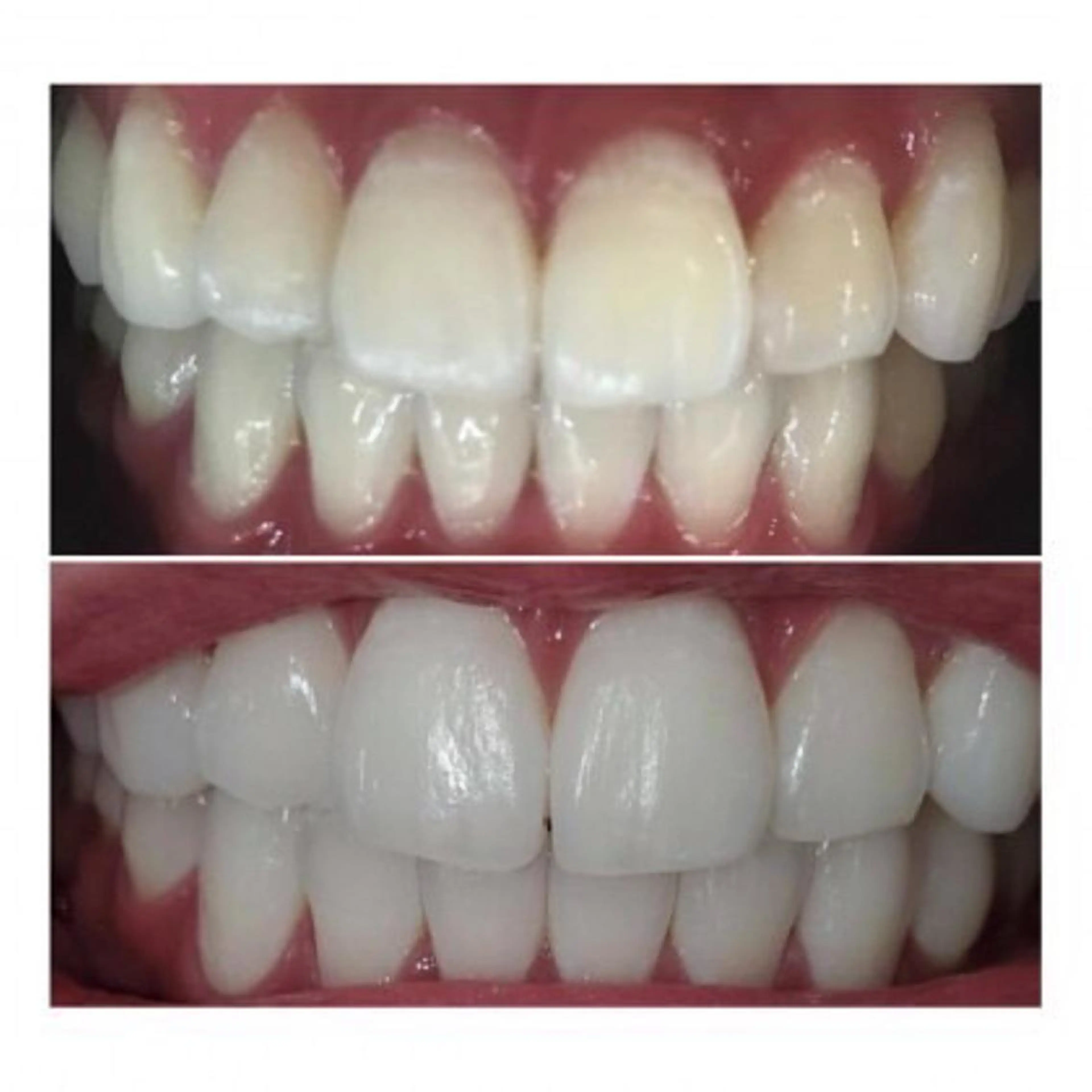 M渋谷 ホワイトニングのエステ・リラクイメージ