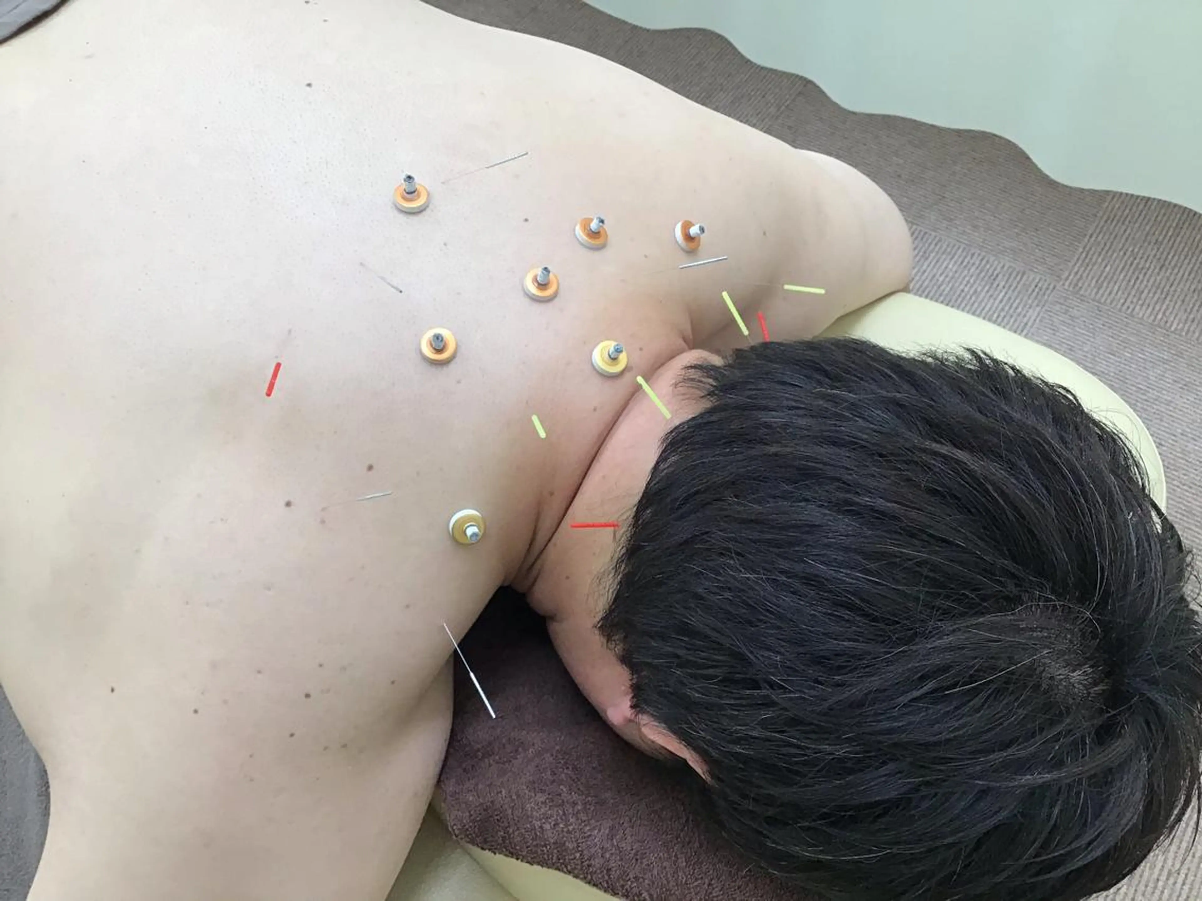 エステ リラク まごころ鍼灸整骨院所属・まごころ鍼灸整骨院 京王堀之内院のエステ・リラクイメージ