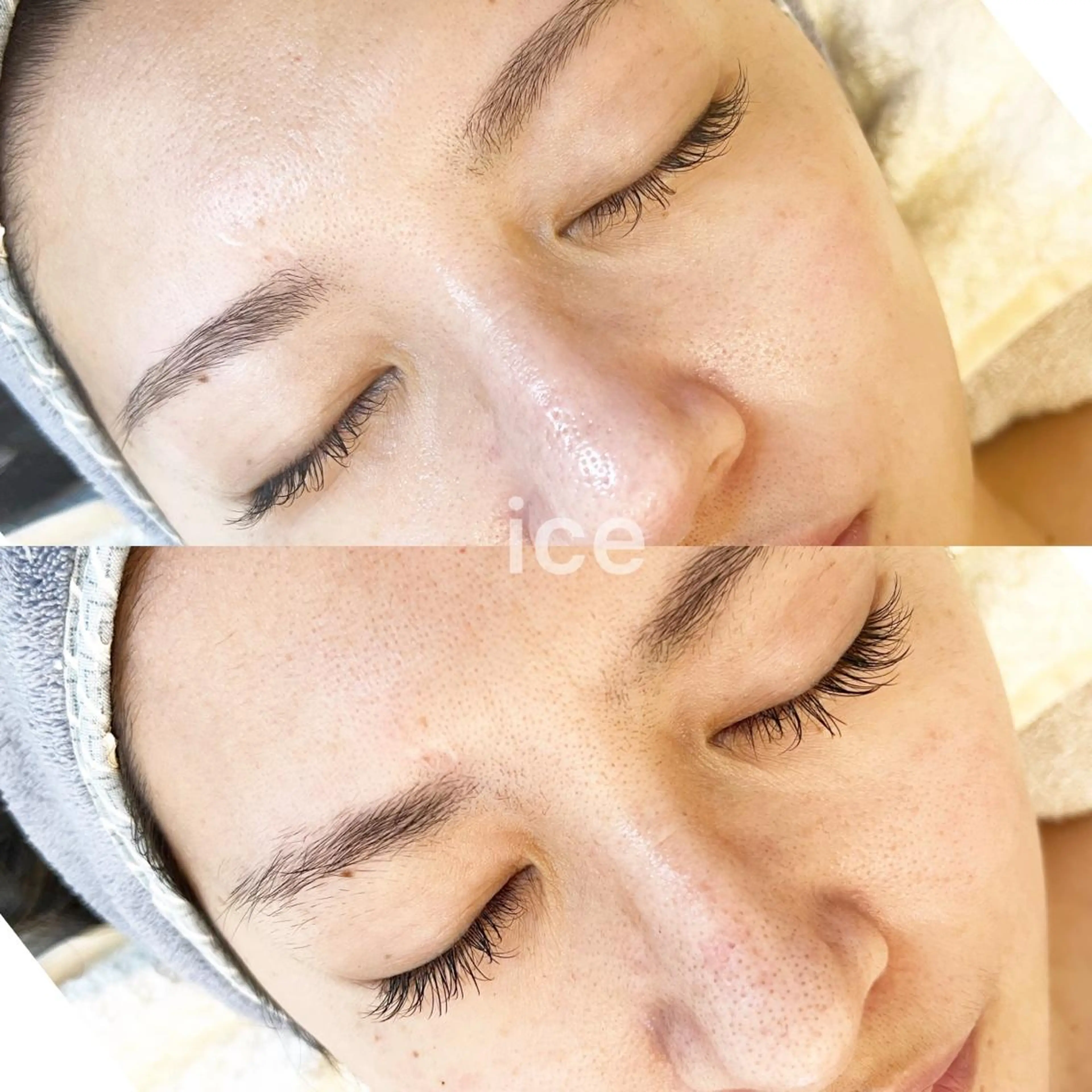 アイブロウ ワックス脱毛専門店 ICE北千住のエステ・リラクイメージ