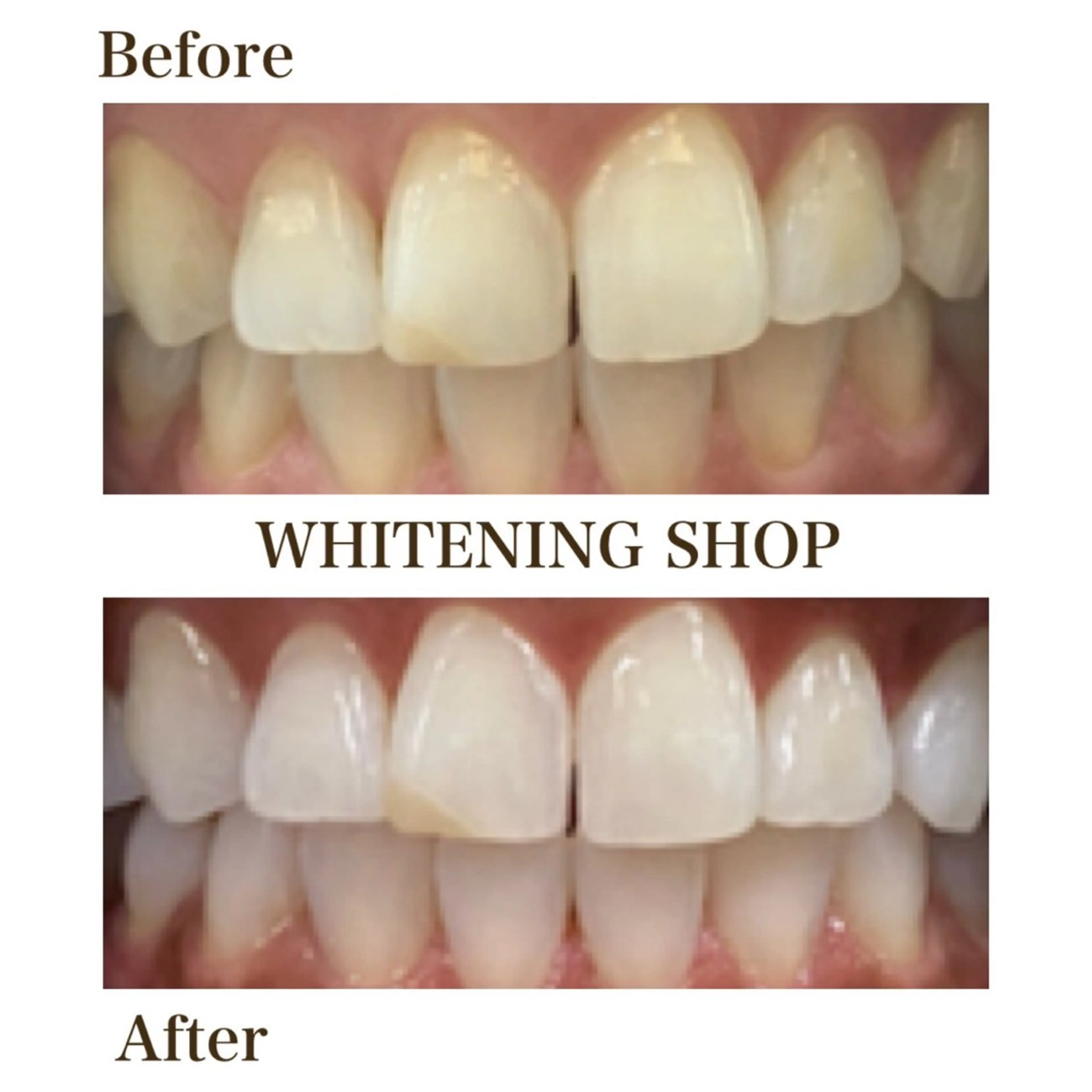 メンズ 学生(メンズ向け) ホワイトニング ショップ川越店のエステ・リラクイメージ