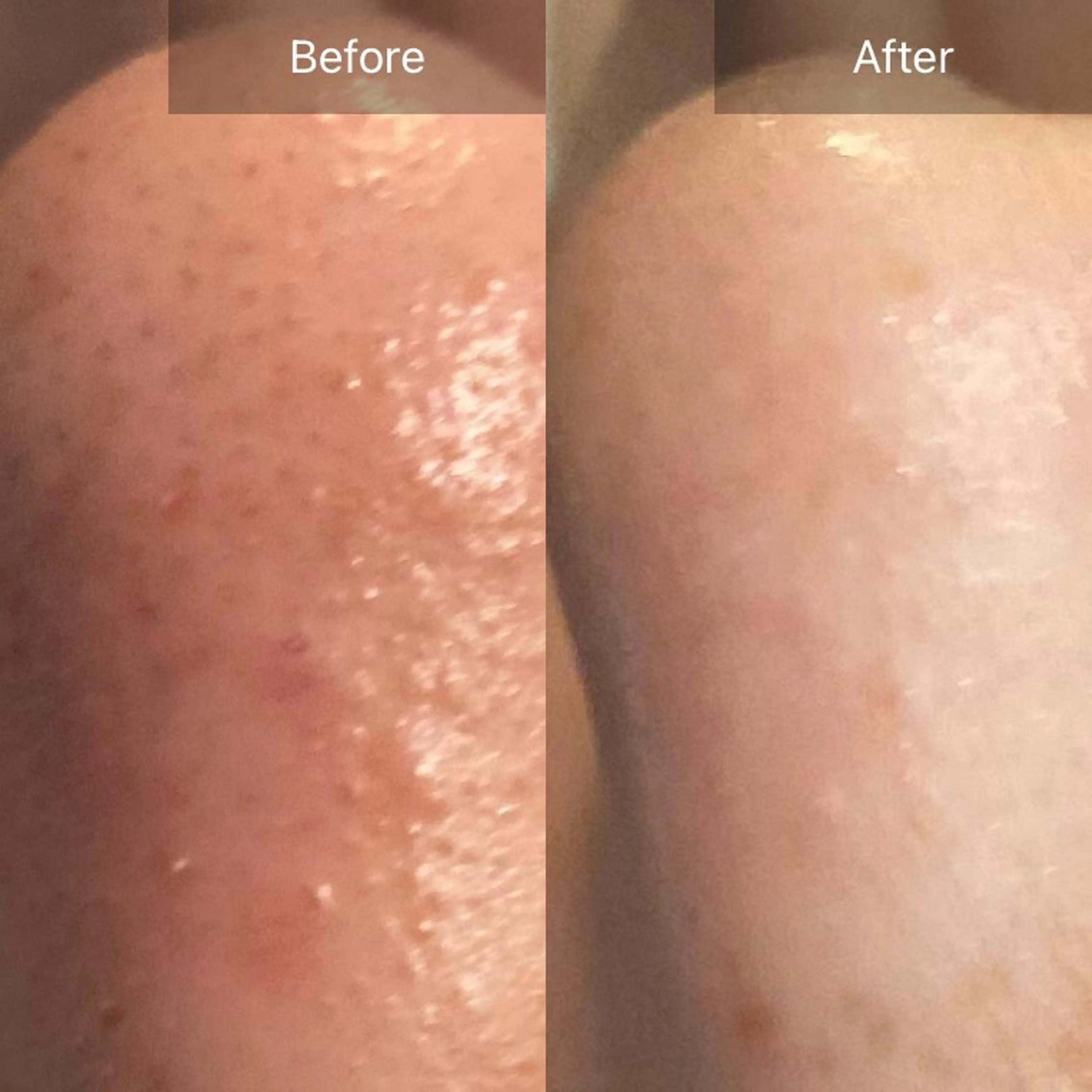 Mandarin Orange所属・毛穴から始める肌メン テマンダリンオレンジのエステ・リラクイメージ