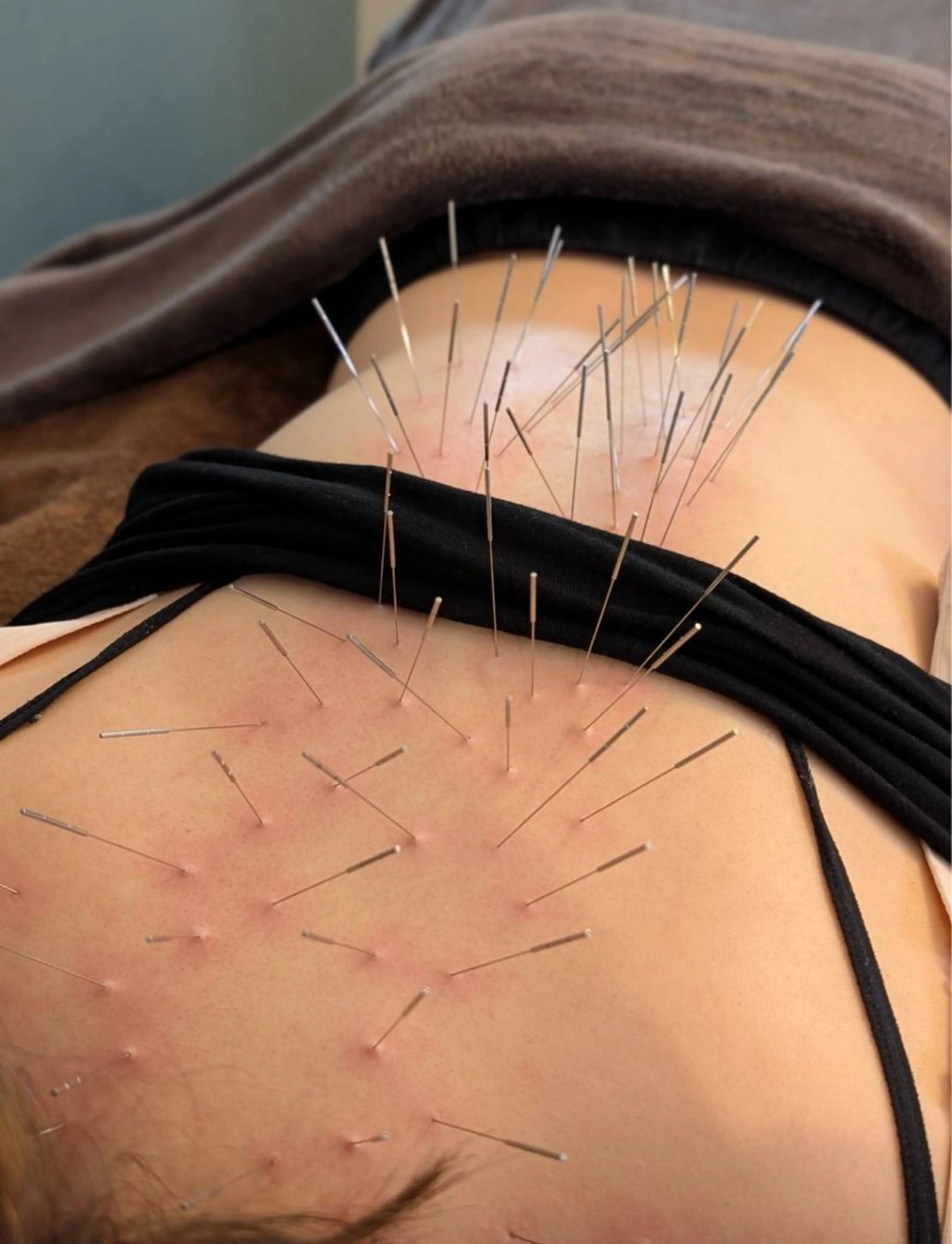 耳ツボ/体質改善/ 温活La mer月島のその他イメージ