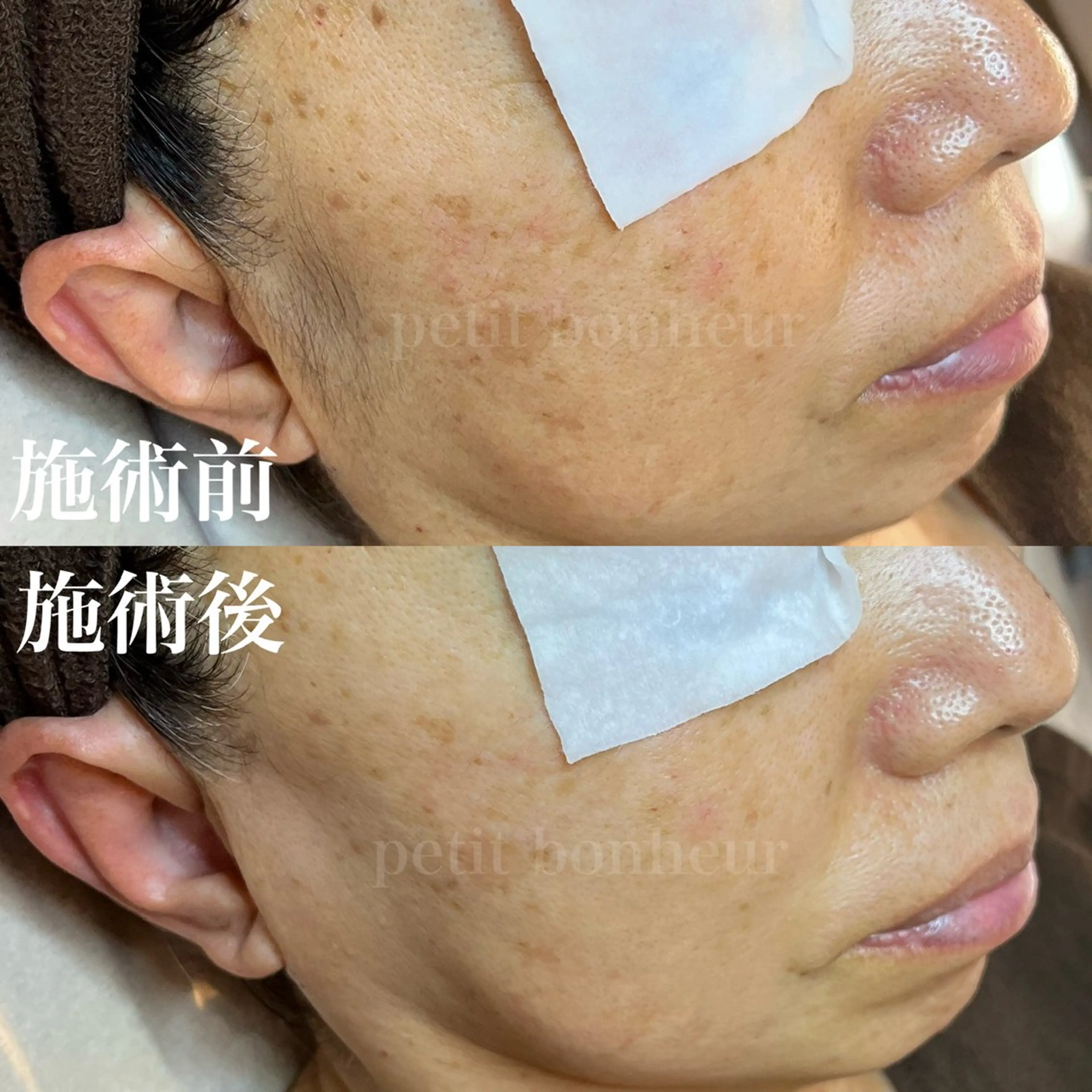 エステ 槙谷 あさみのエステ・リラクイメージ