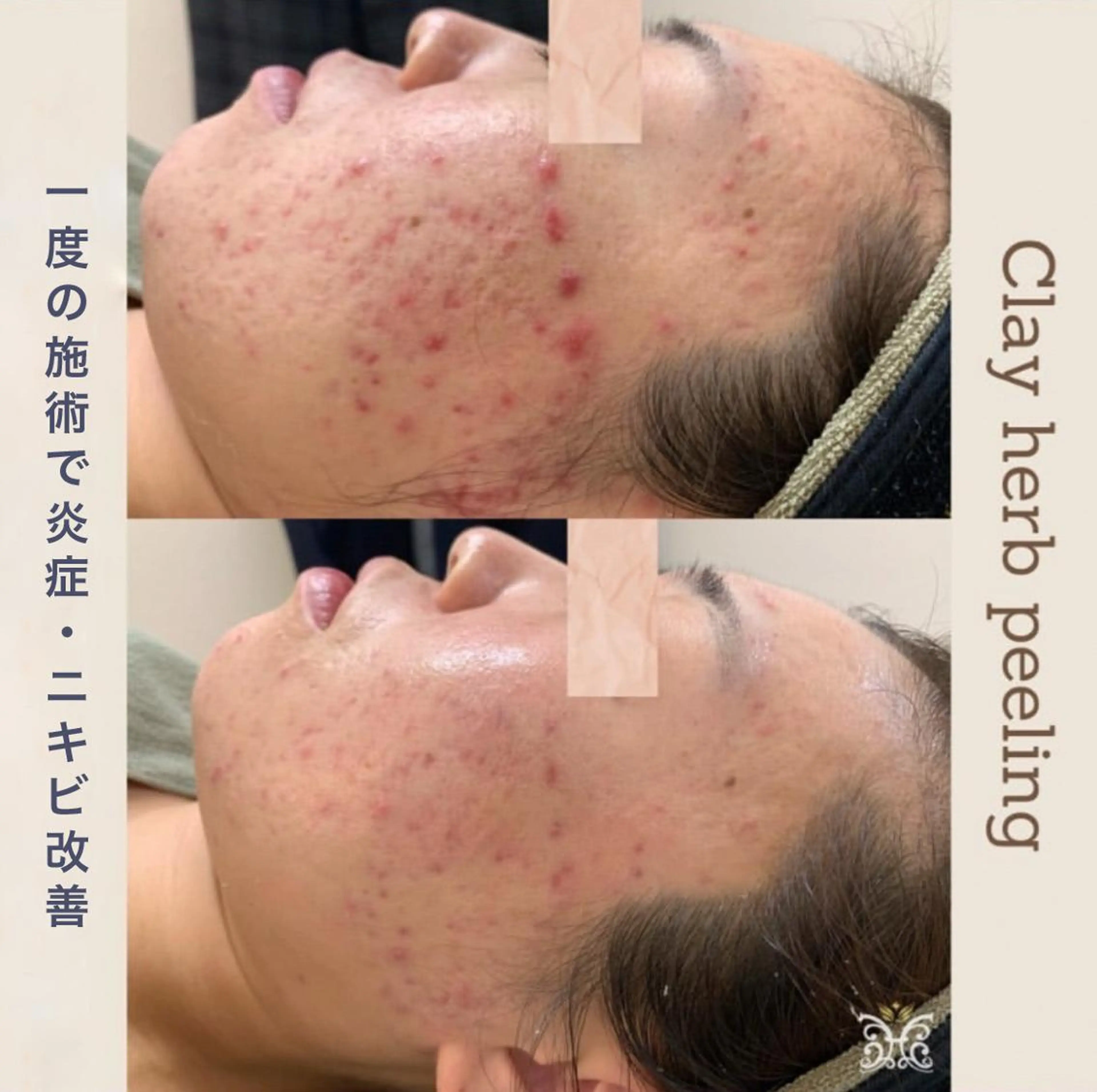 美肌&アロマ🌸 nana 中目黒のエステ・リラクイメージ