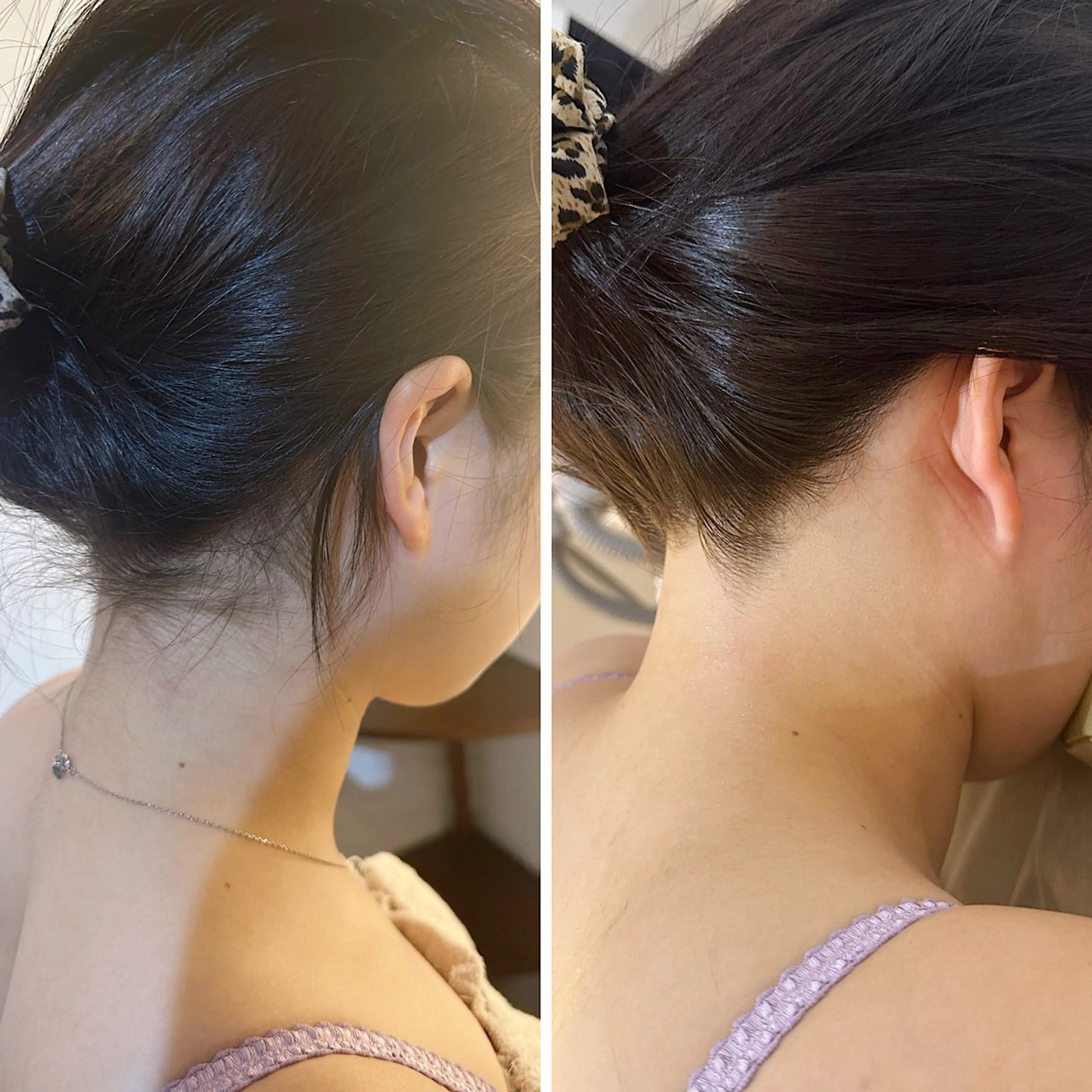 脱毛 うなじ脱毛/美肌脱毛 LABELのエステ・リラクイメージ