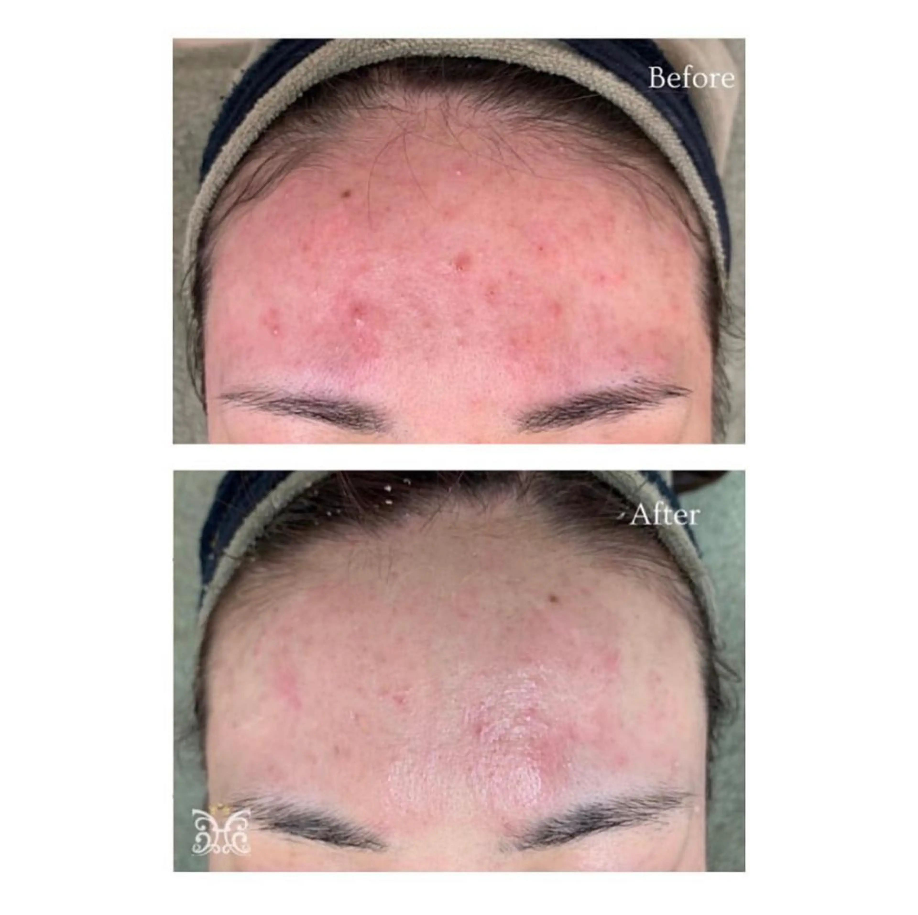 Bellmore ＋のエステ・リラクイメージ