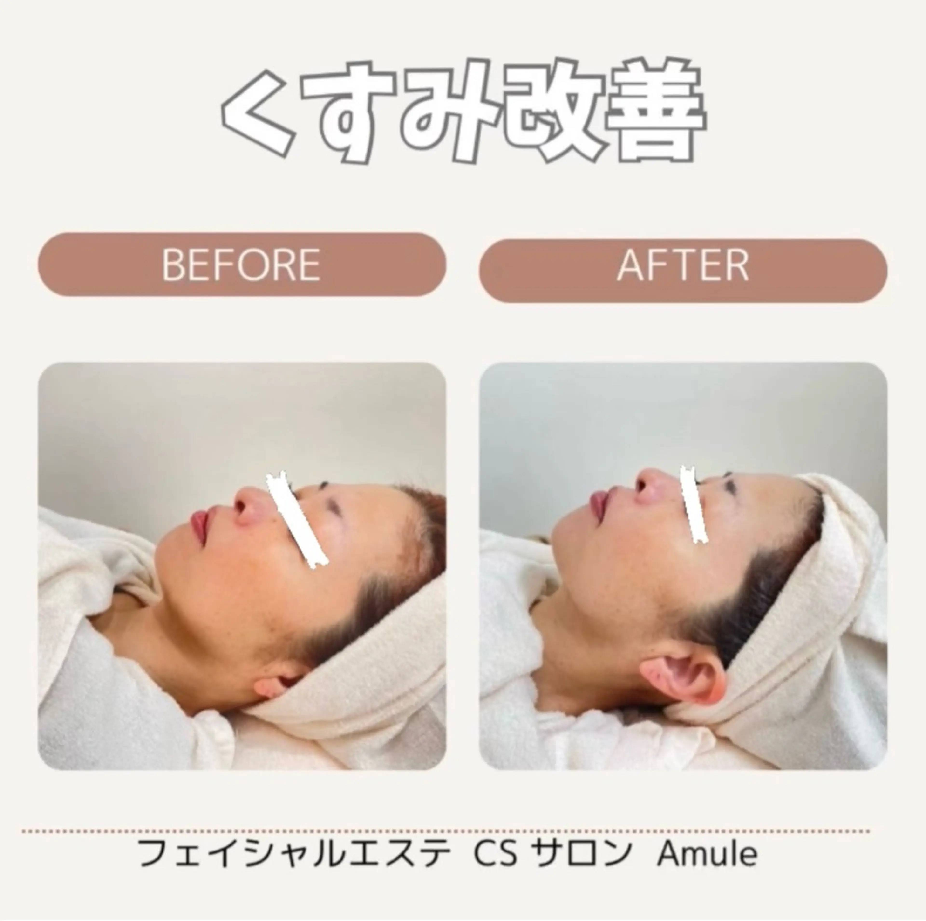 Amule anna🦋のエステ・リラクイメージ