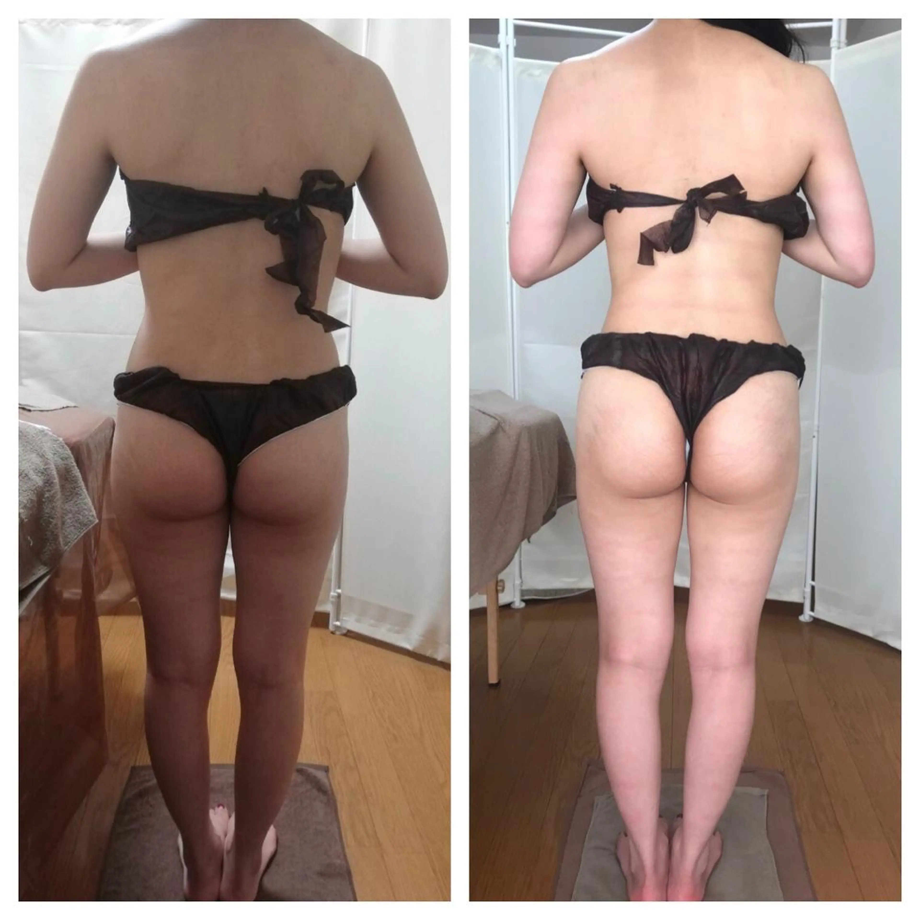 《本気痩せ×疲労改善 》  BILOOPのエステ・リラクイメージ