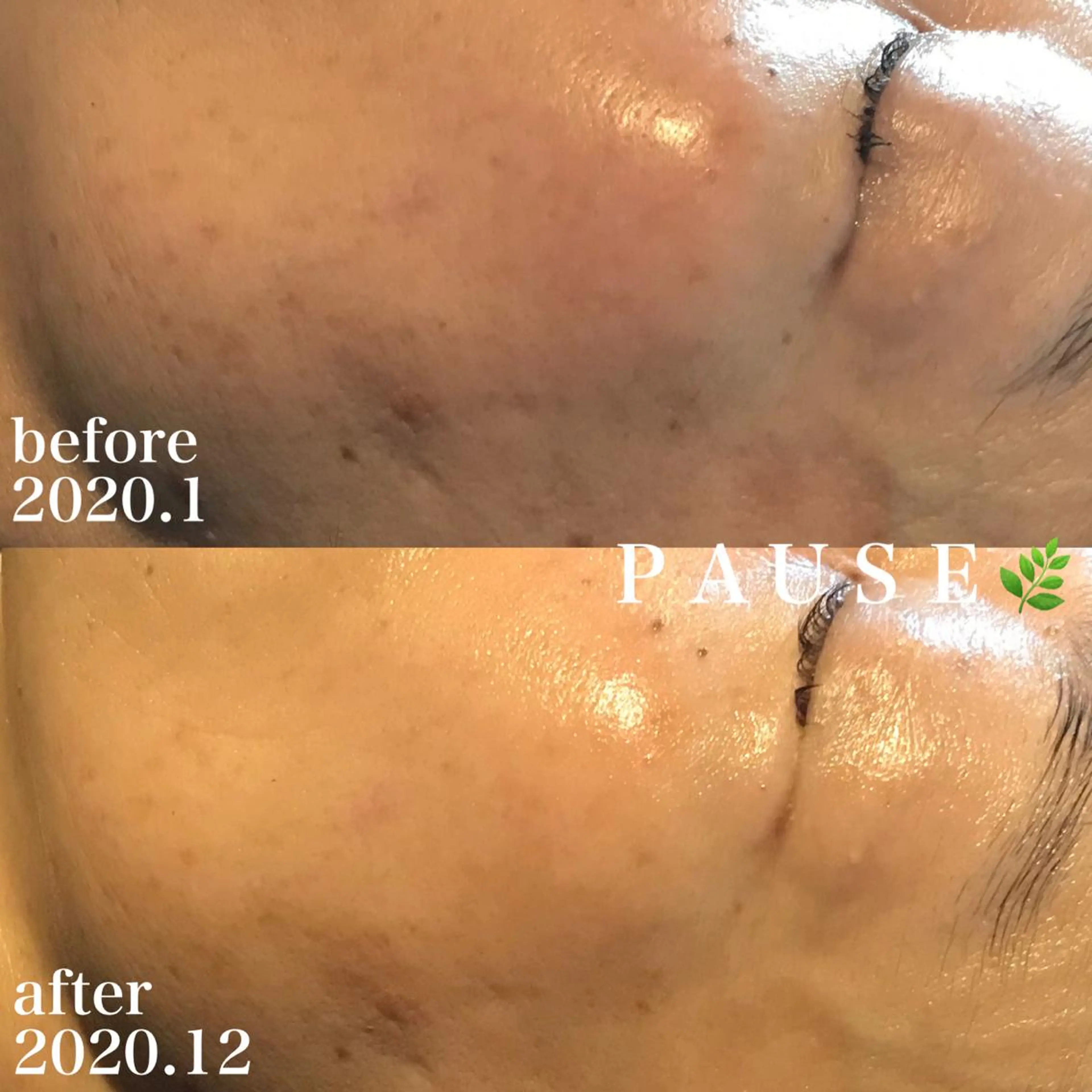 エステ 浜野 恵美のエステ・リラクイメージ