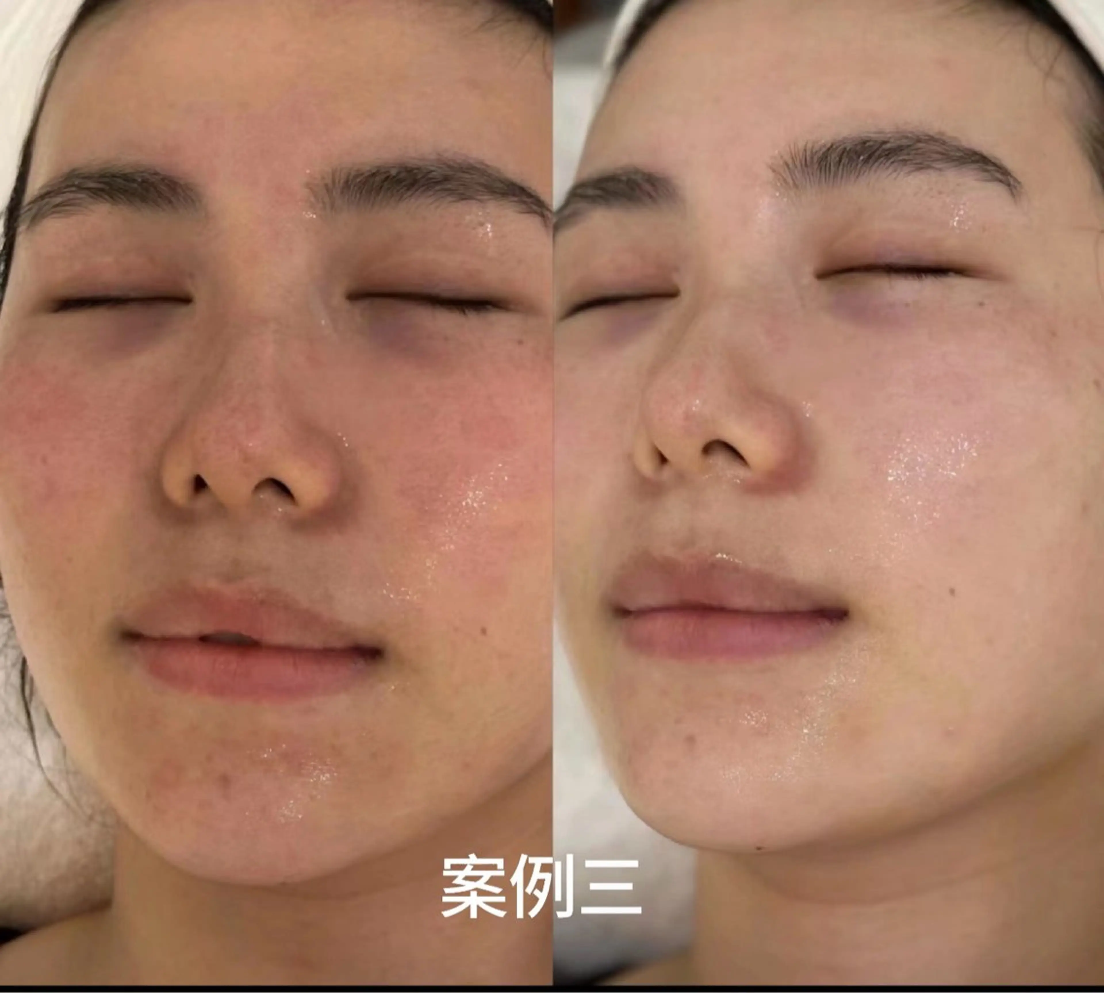 Queen Salonのエステ・リラクイメージ