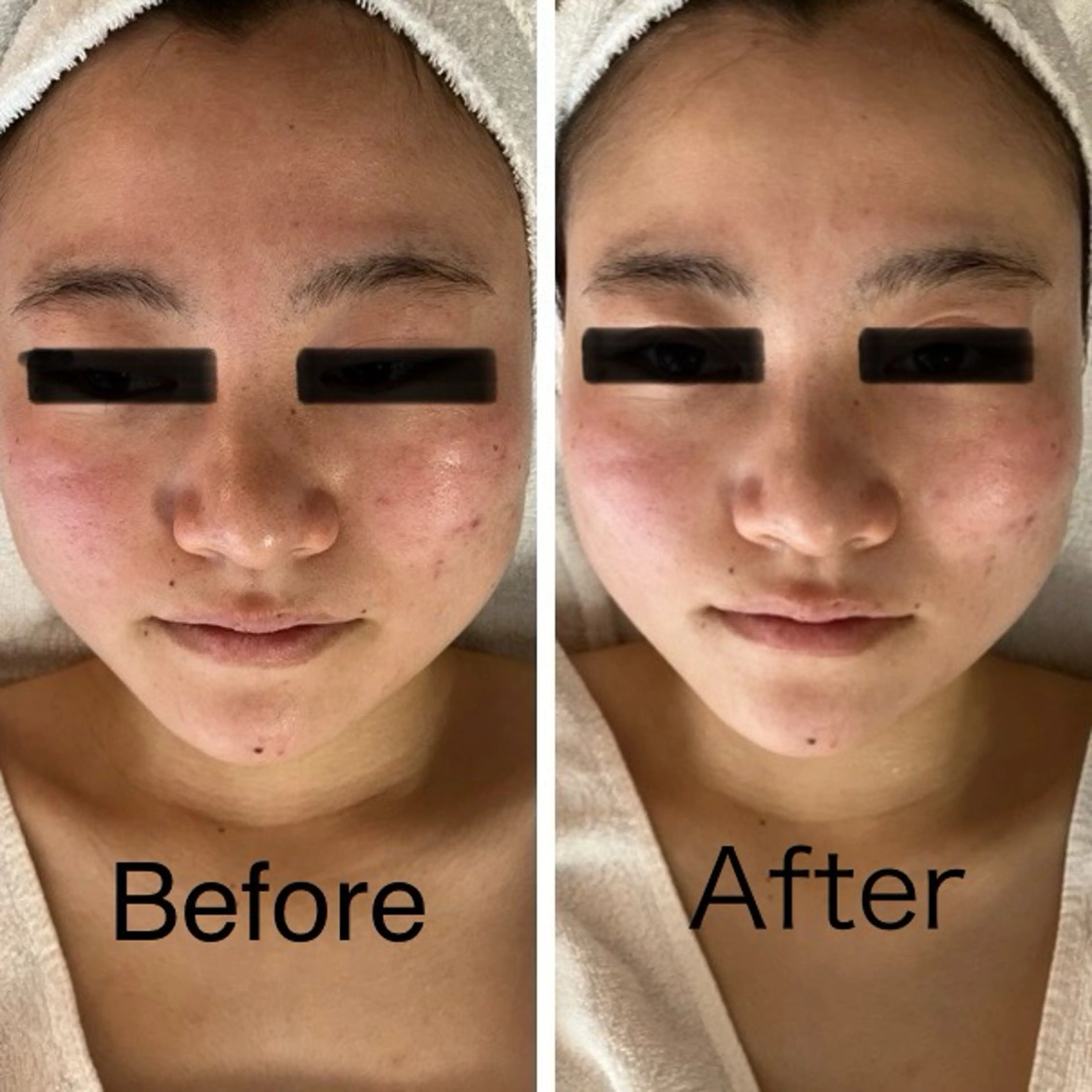 エステ エステサロン Minkのエステ・リラクイメージ