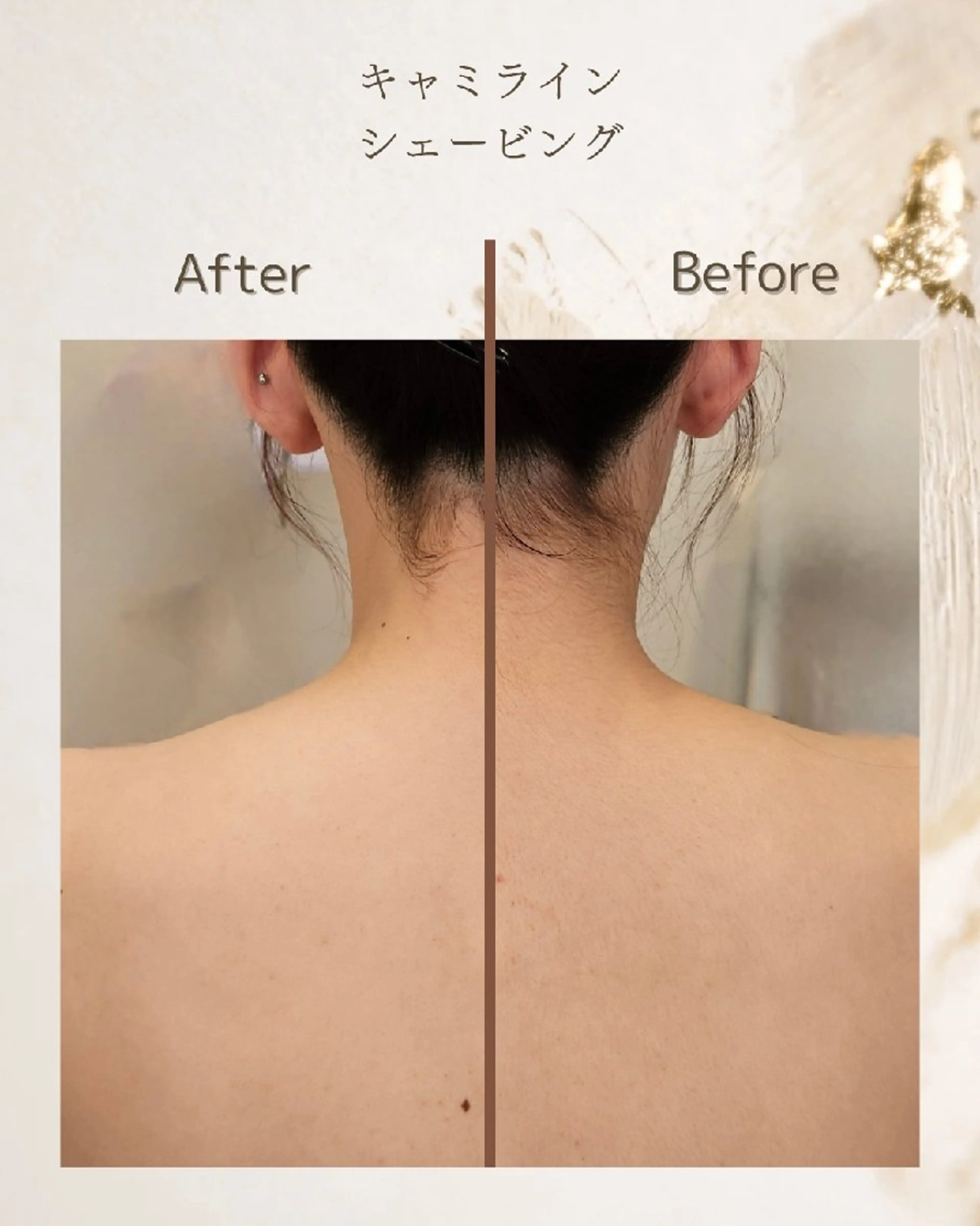 【顔/背中】顔&背中上段シェービングの写真