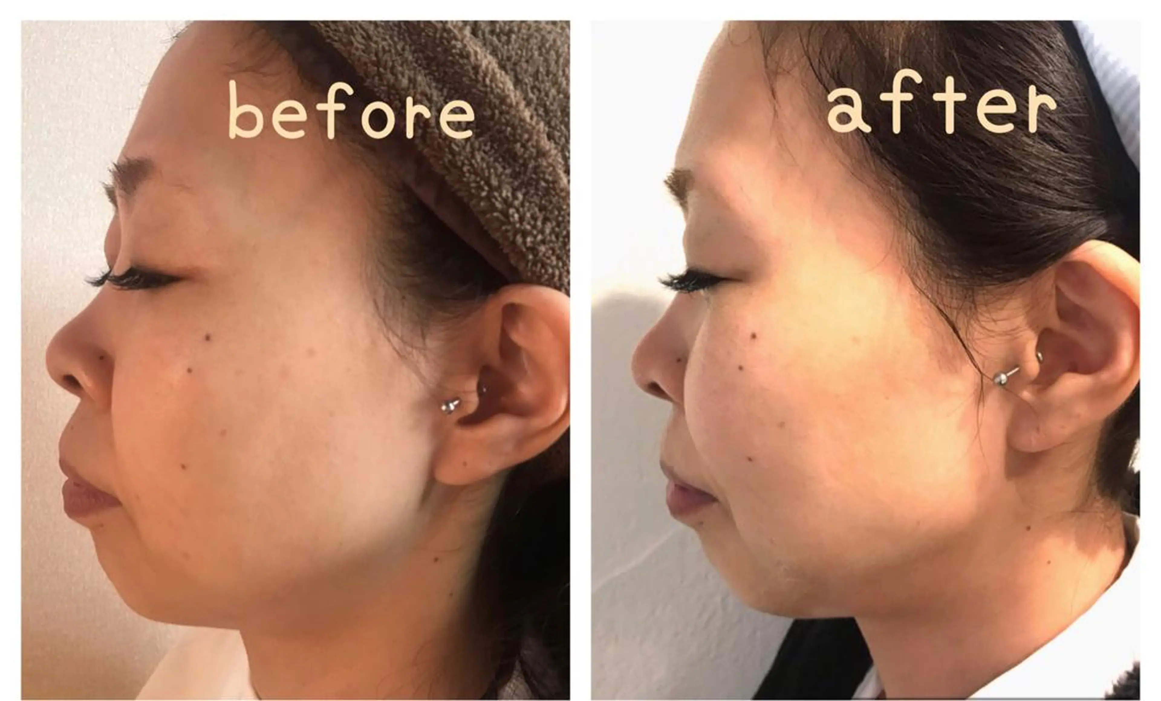 Yoshino Erinaのエステ・リラクイメージ