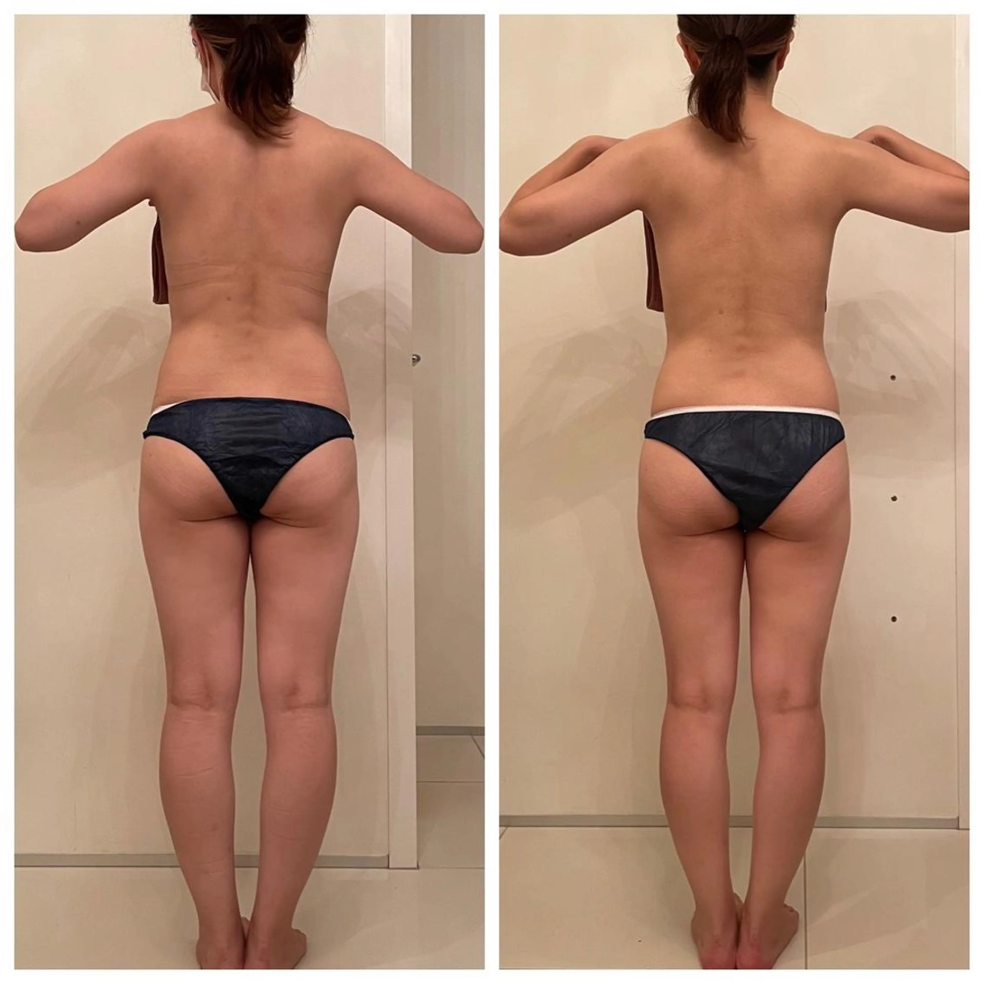 脱毛・痩身強化サロン リアンメルシー佐々木のエステ・リラクイメージ