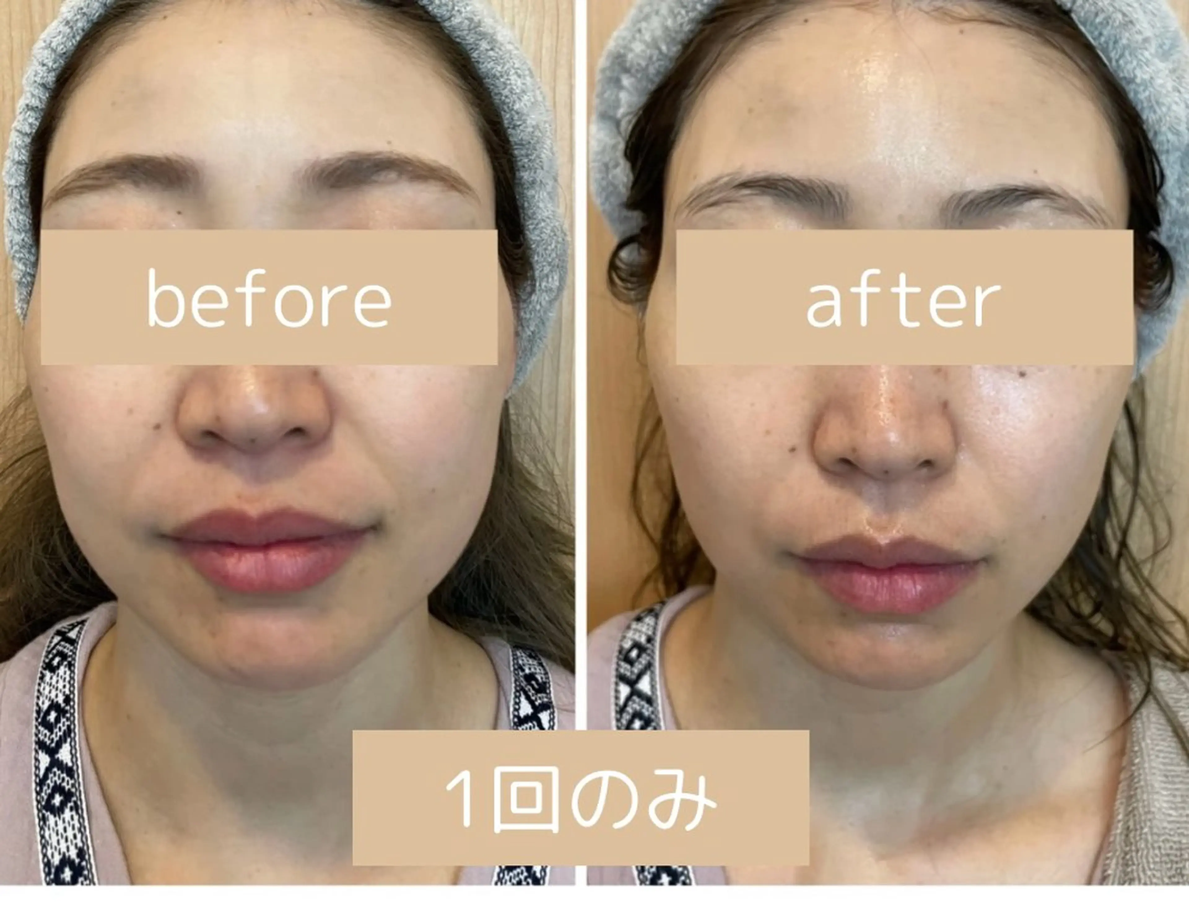 【韓国肌管理】無添加天然ハーブピーリング/剥離なし/肌艶UP/肌トラブル改善の写真